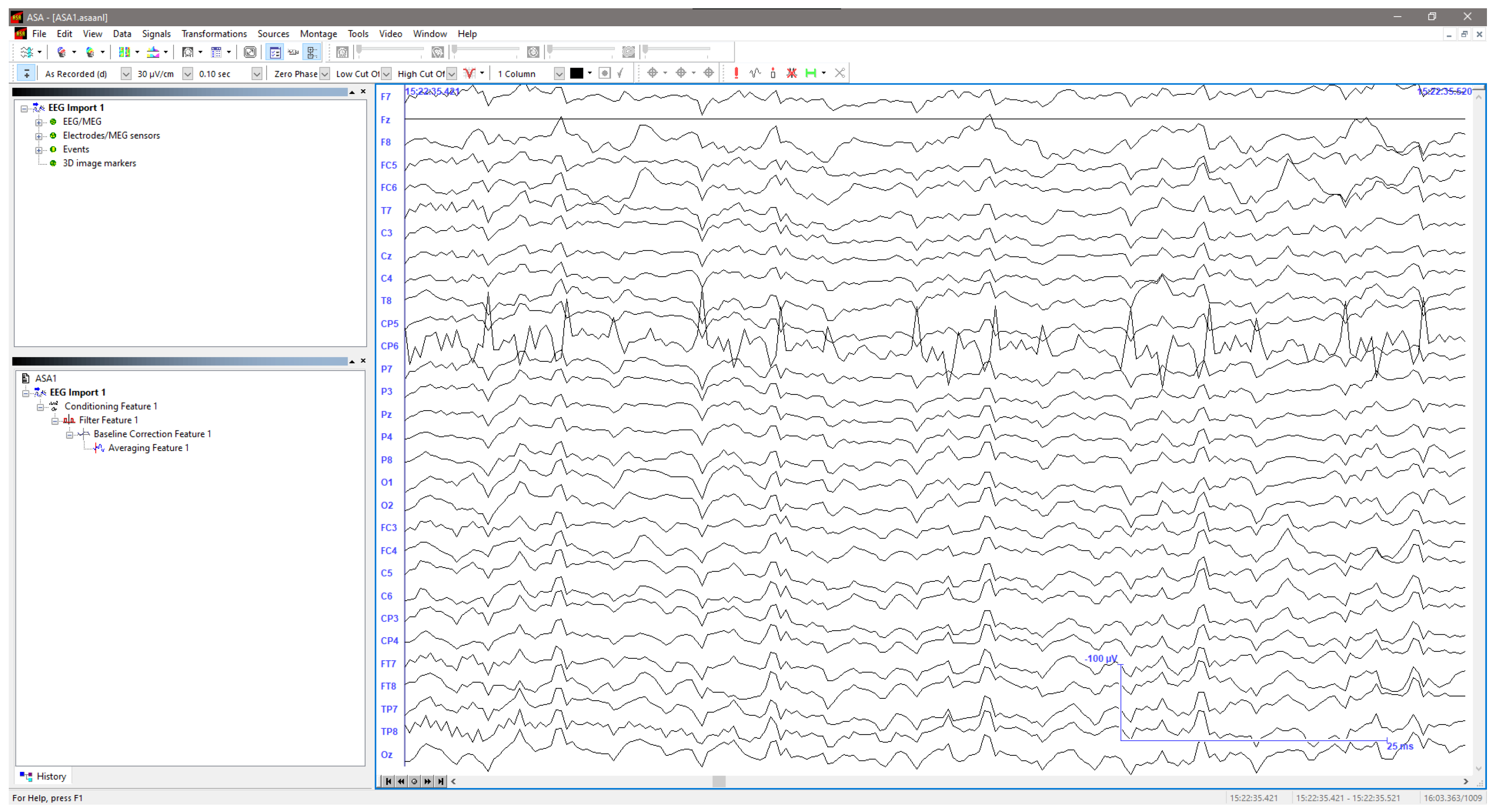 Sensors 25 03355 g007