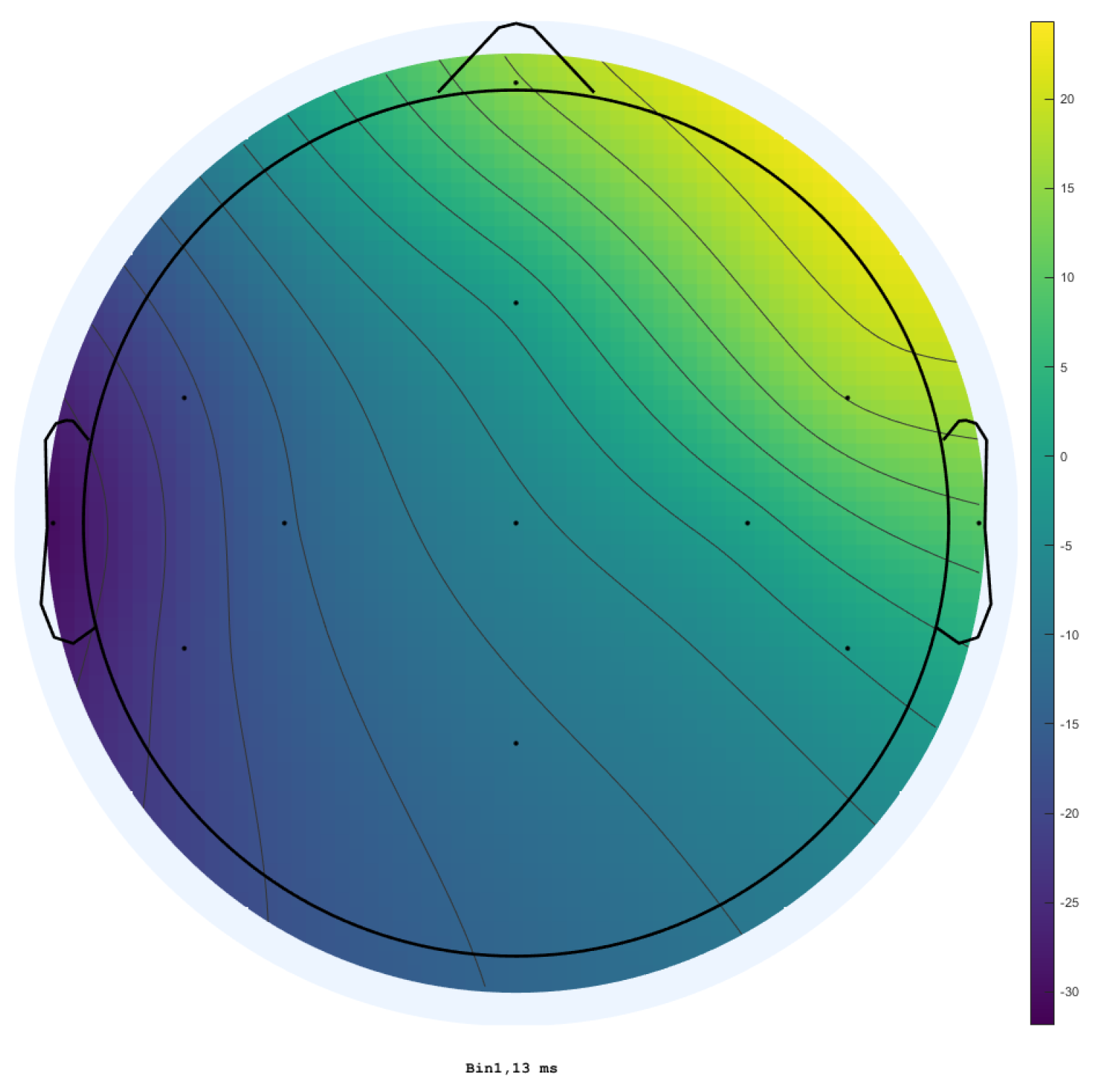 Sensors 25 03355 g011