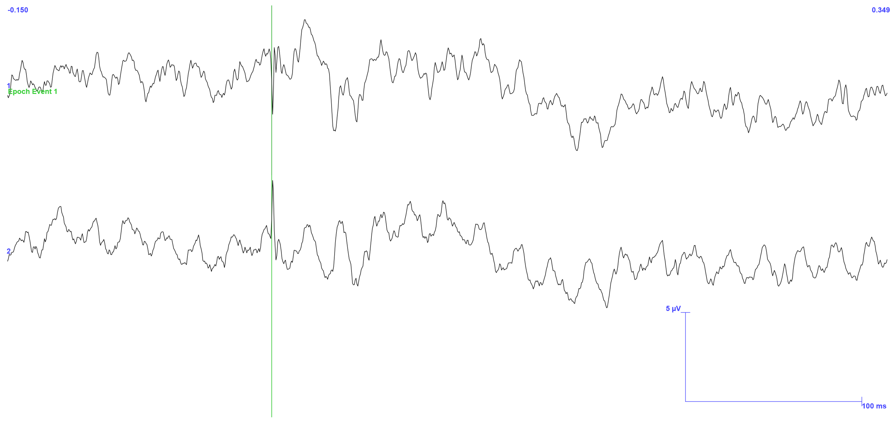 Sensors 25 03355 g012
