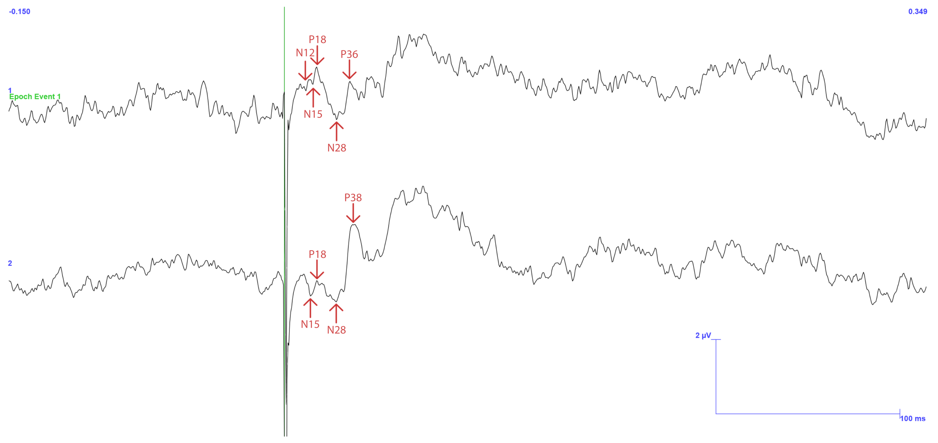 Sensors 25 03355 g014