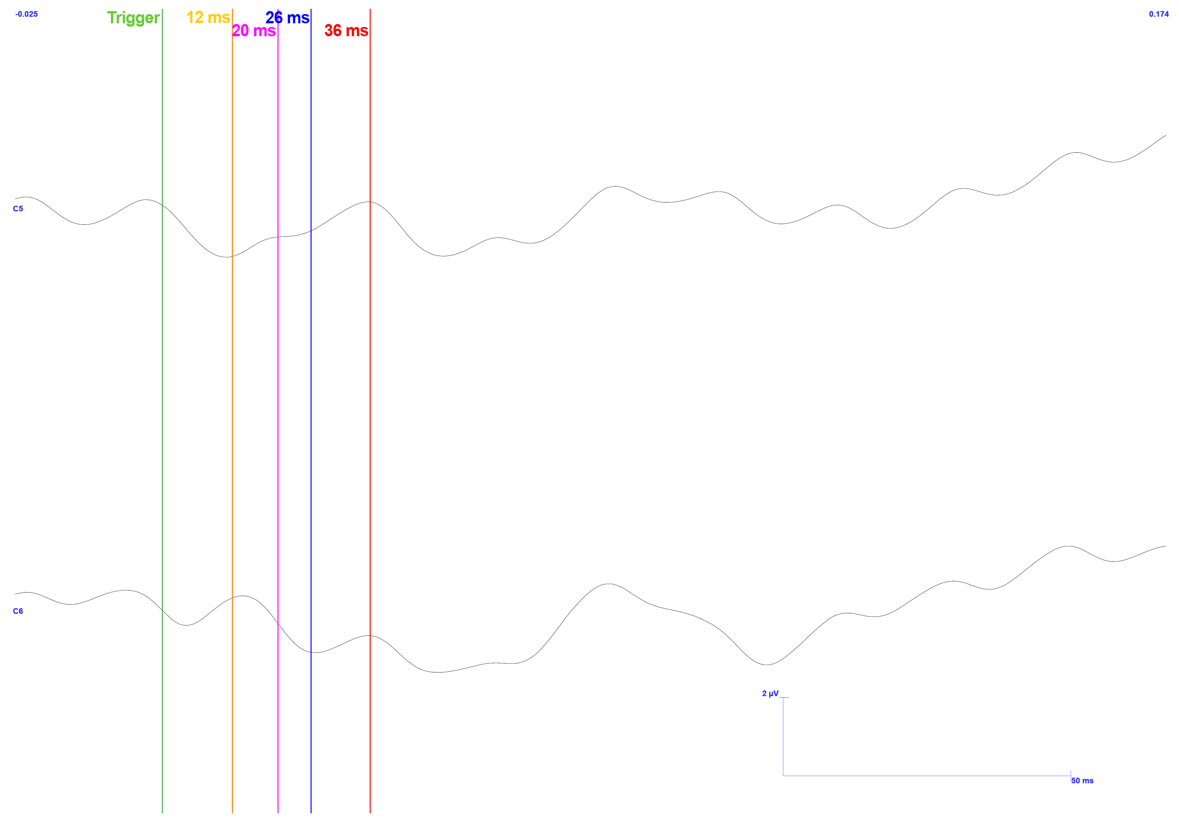 Sensors 25 03355 g016