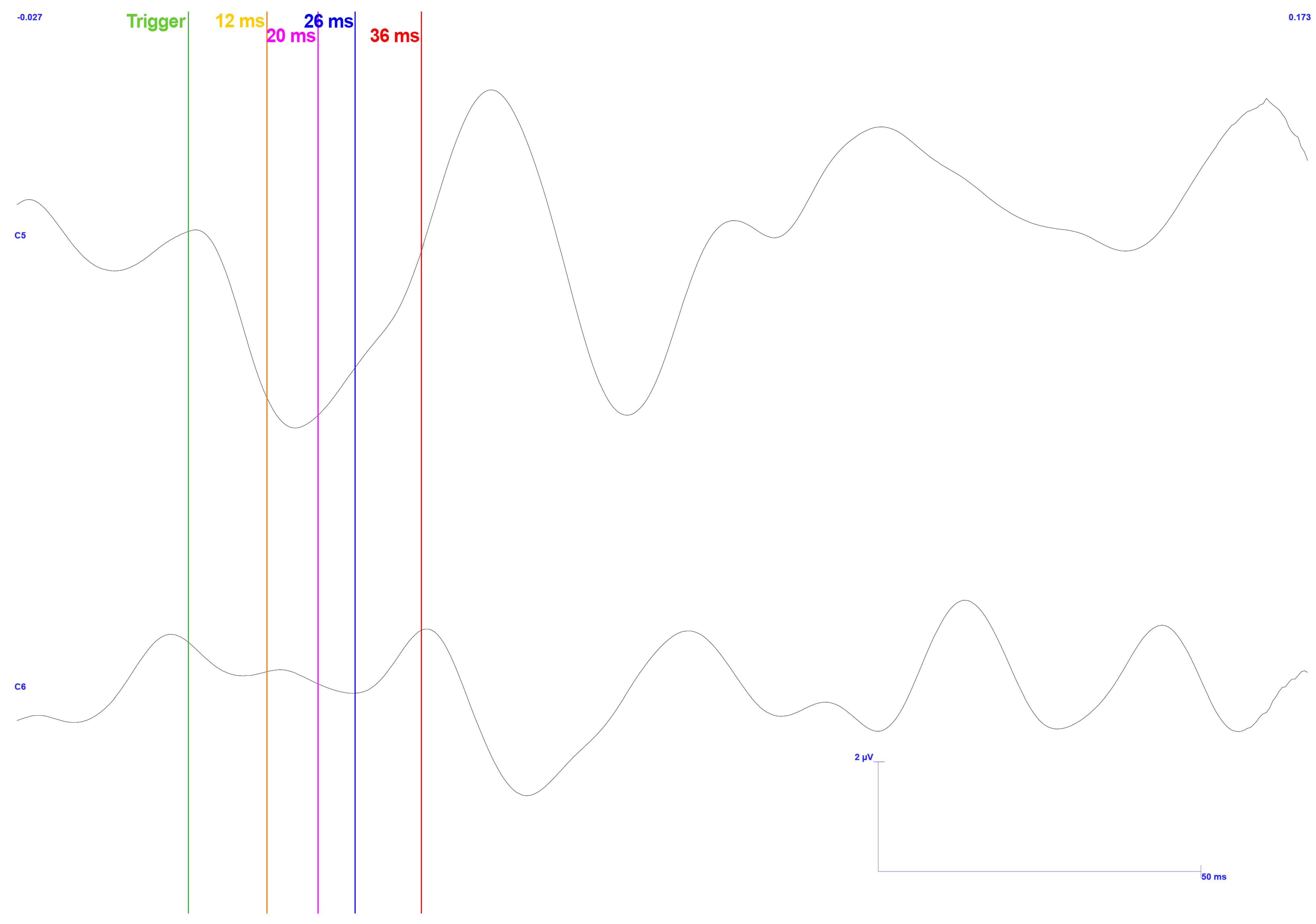 Sensors 25 03355 g018