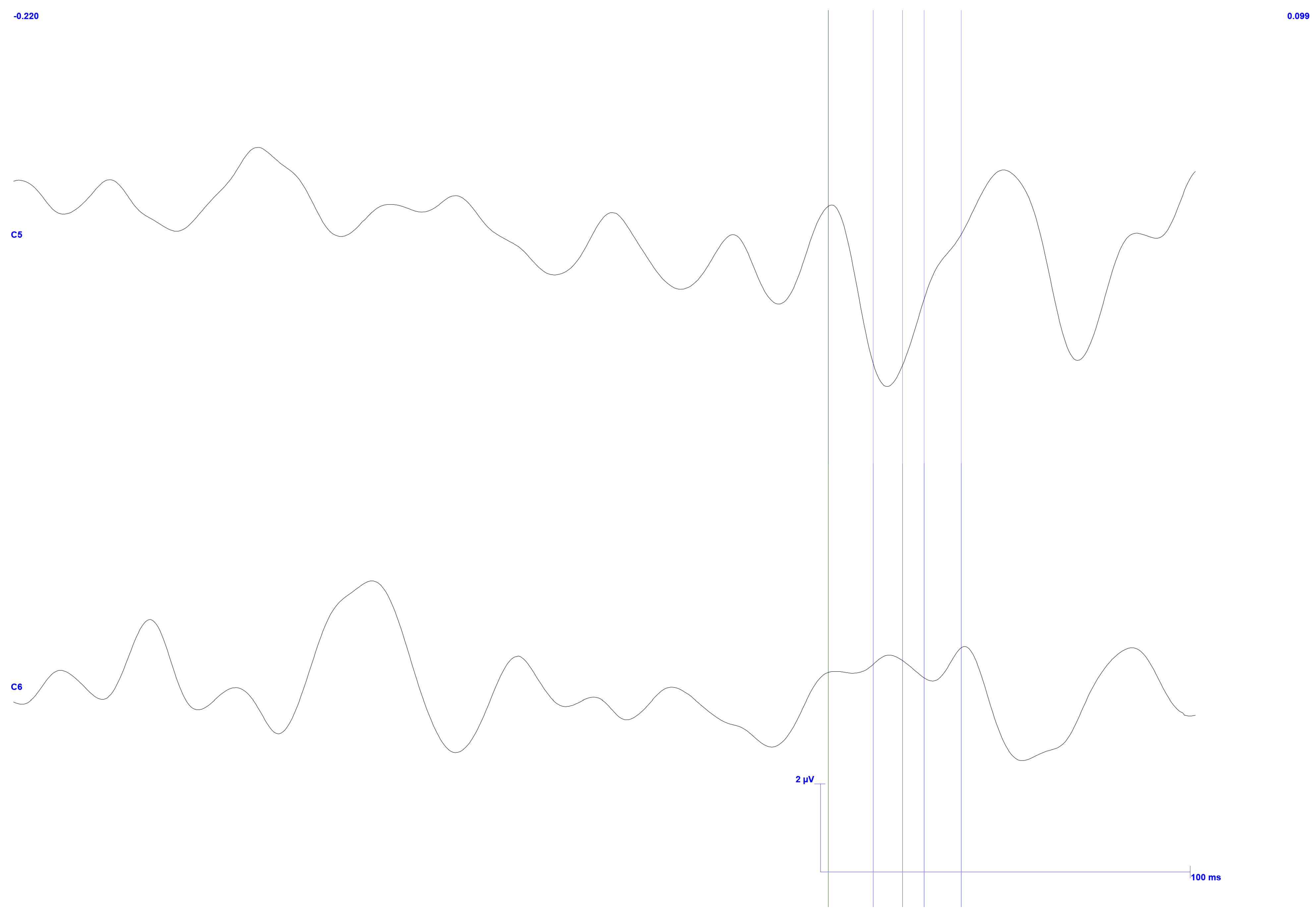 Sensors 25 03355 g021