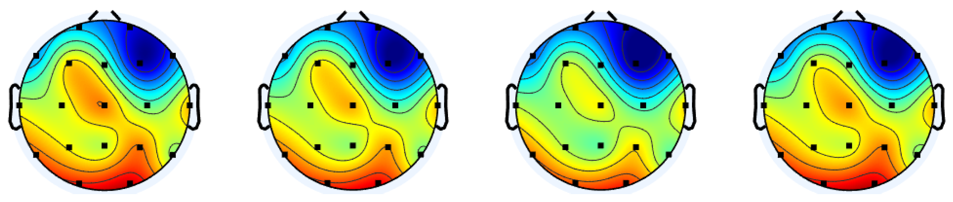 Sensors 25 03389 g004