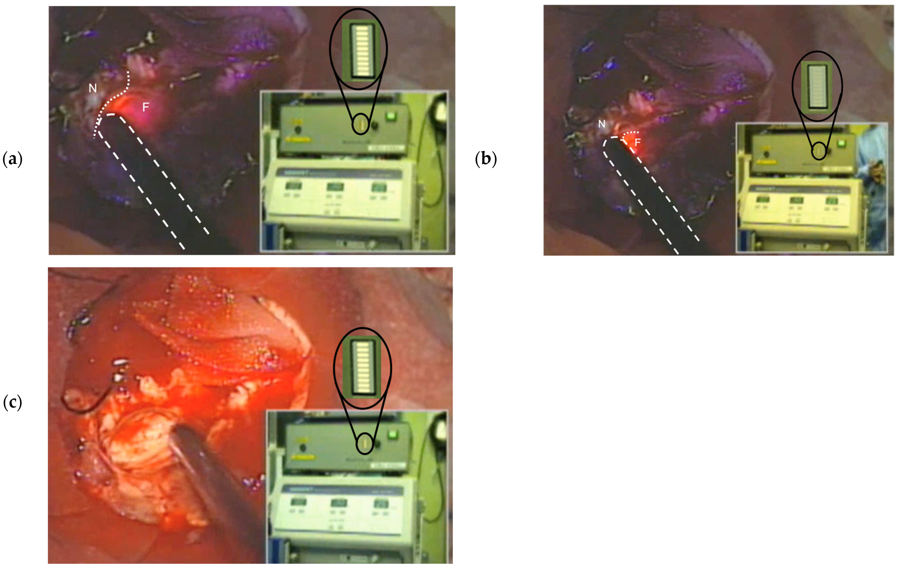 Sensors 25 03412 g007