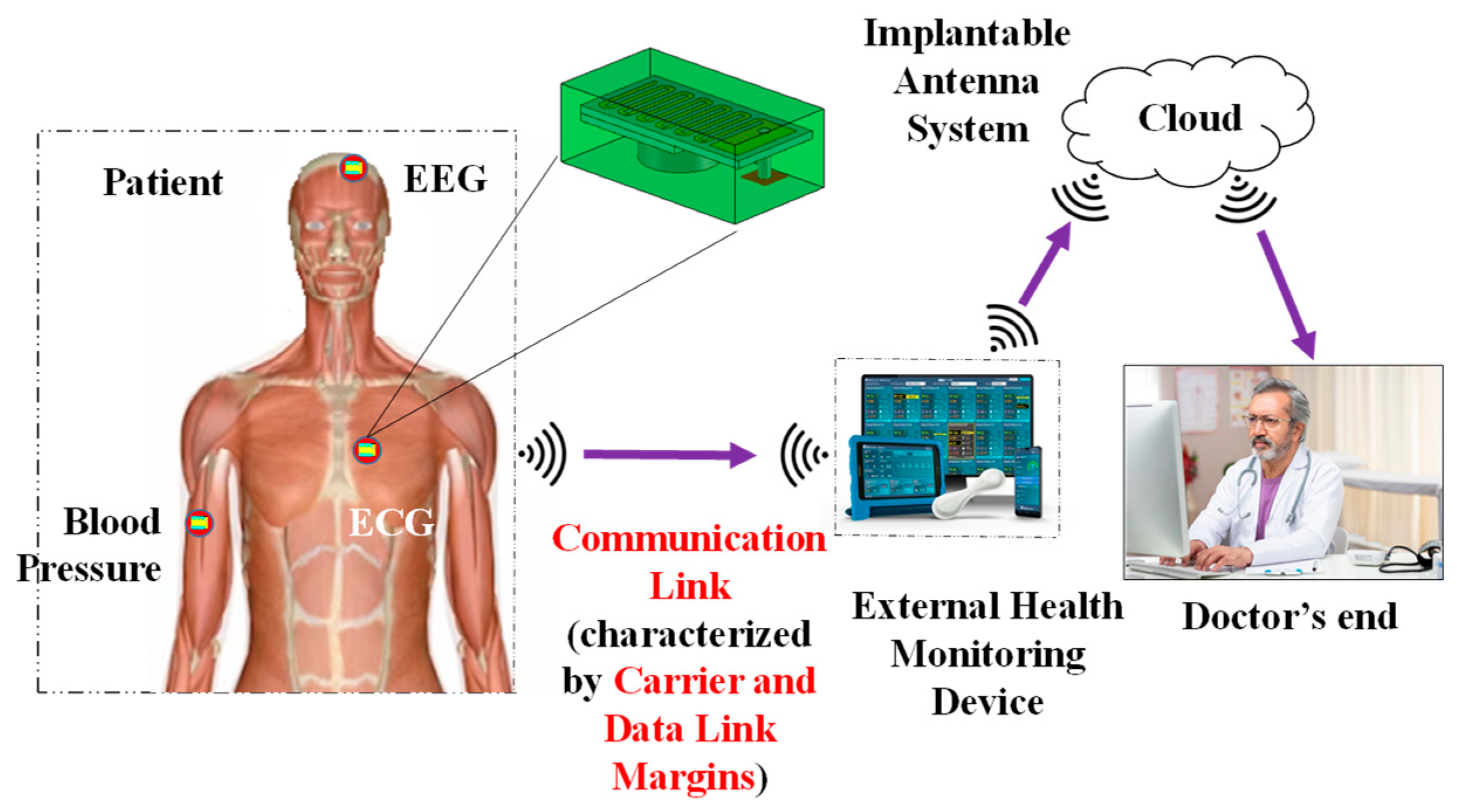 Sensors 25 03498 g001