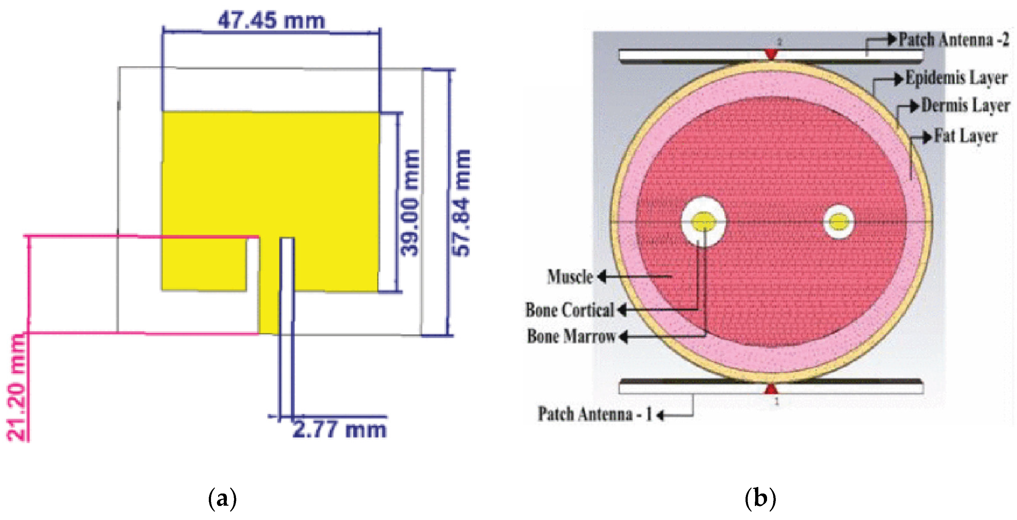 Sensors 25 03591 g003