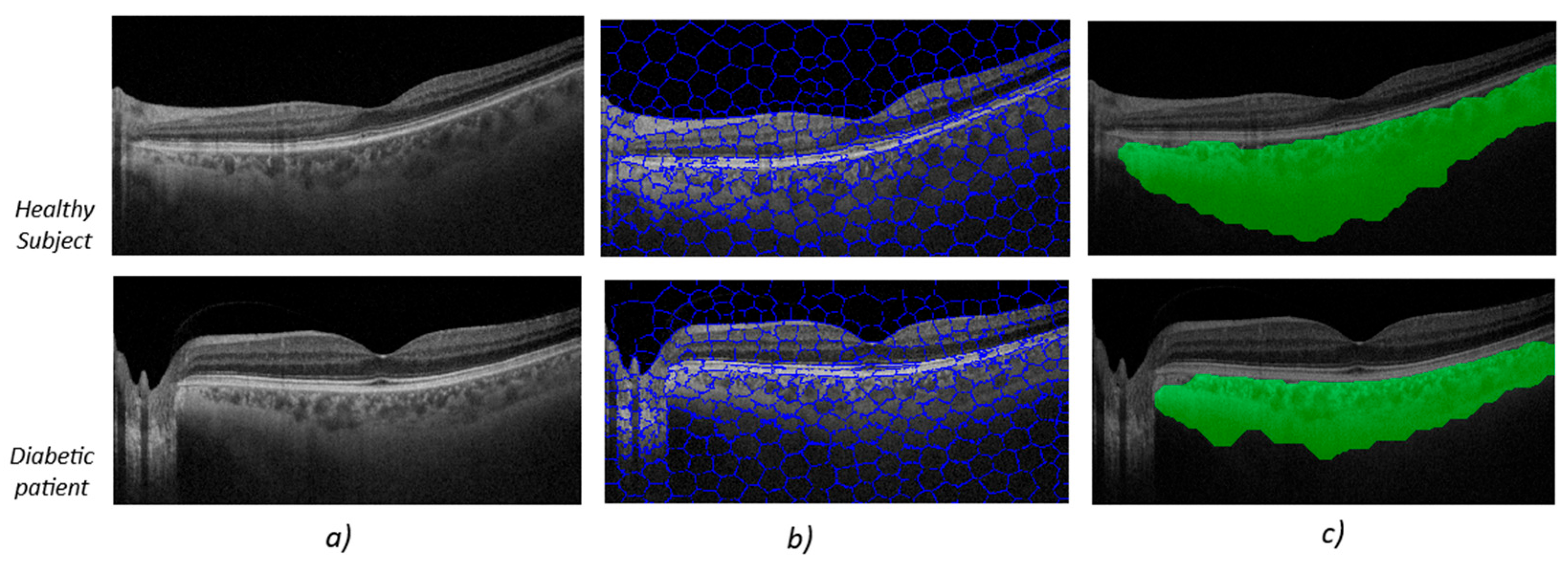 Sensors 25 03619 g002