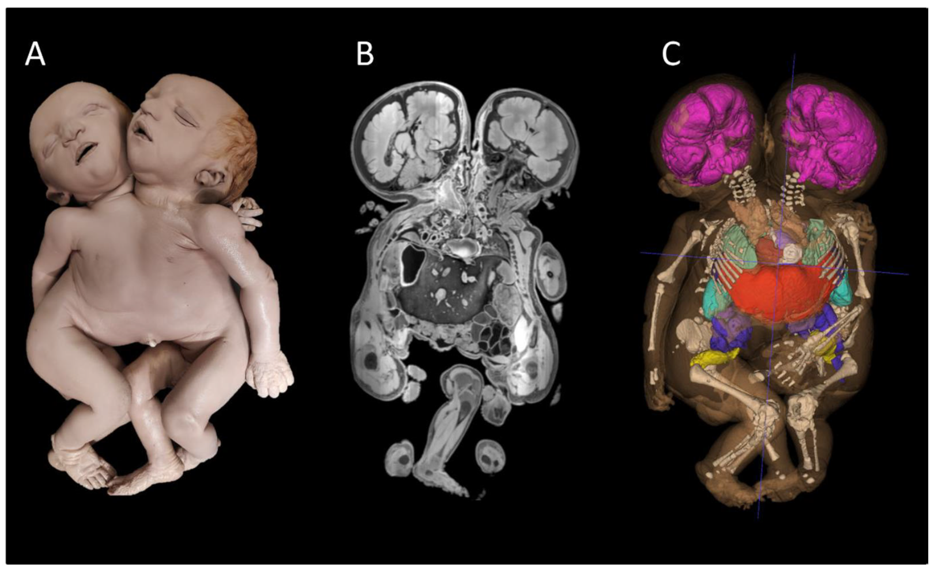 Sensors 25 03683 g002