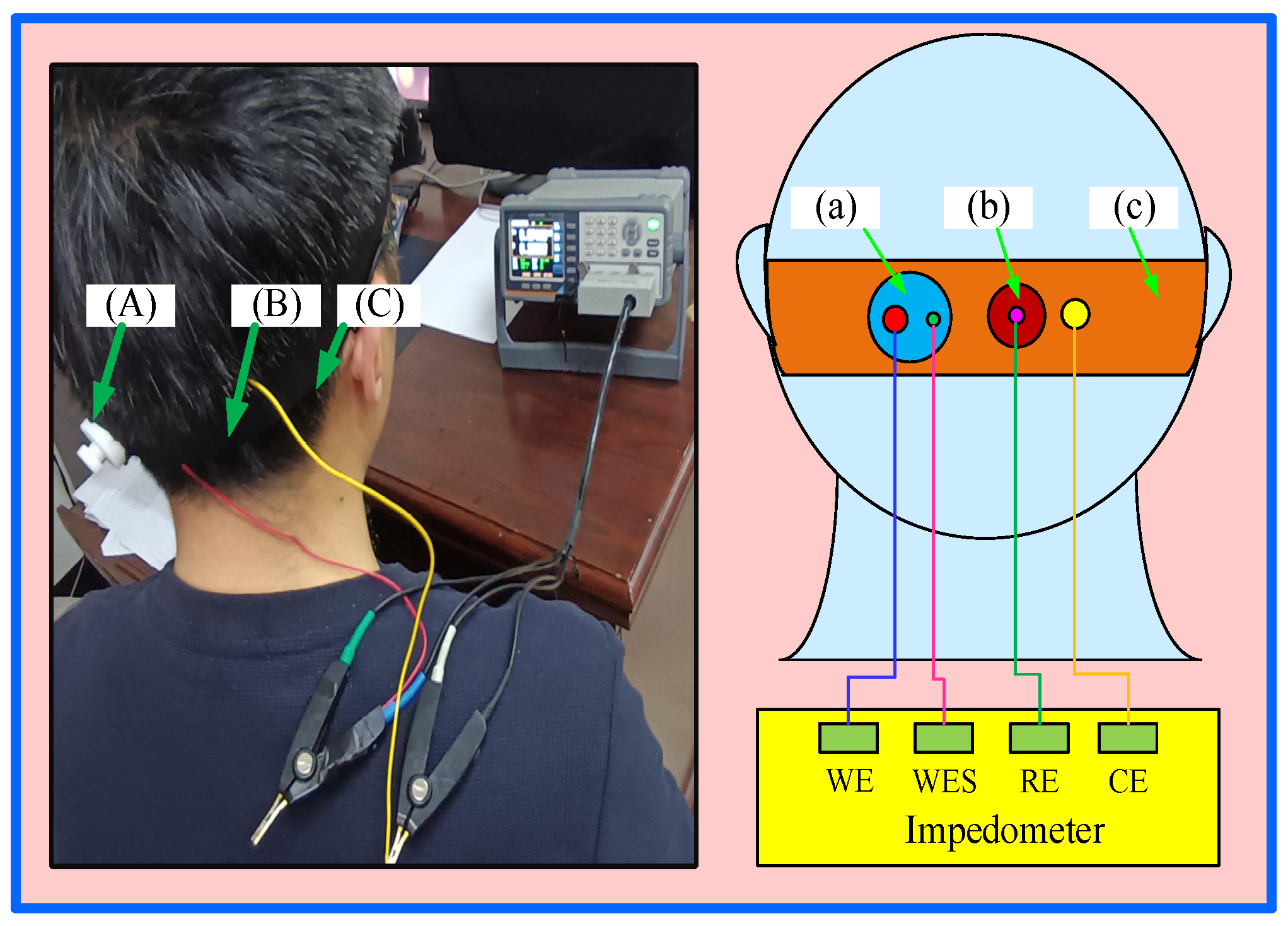 Sensors 25 03994 g003