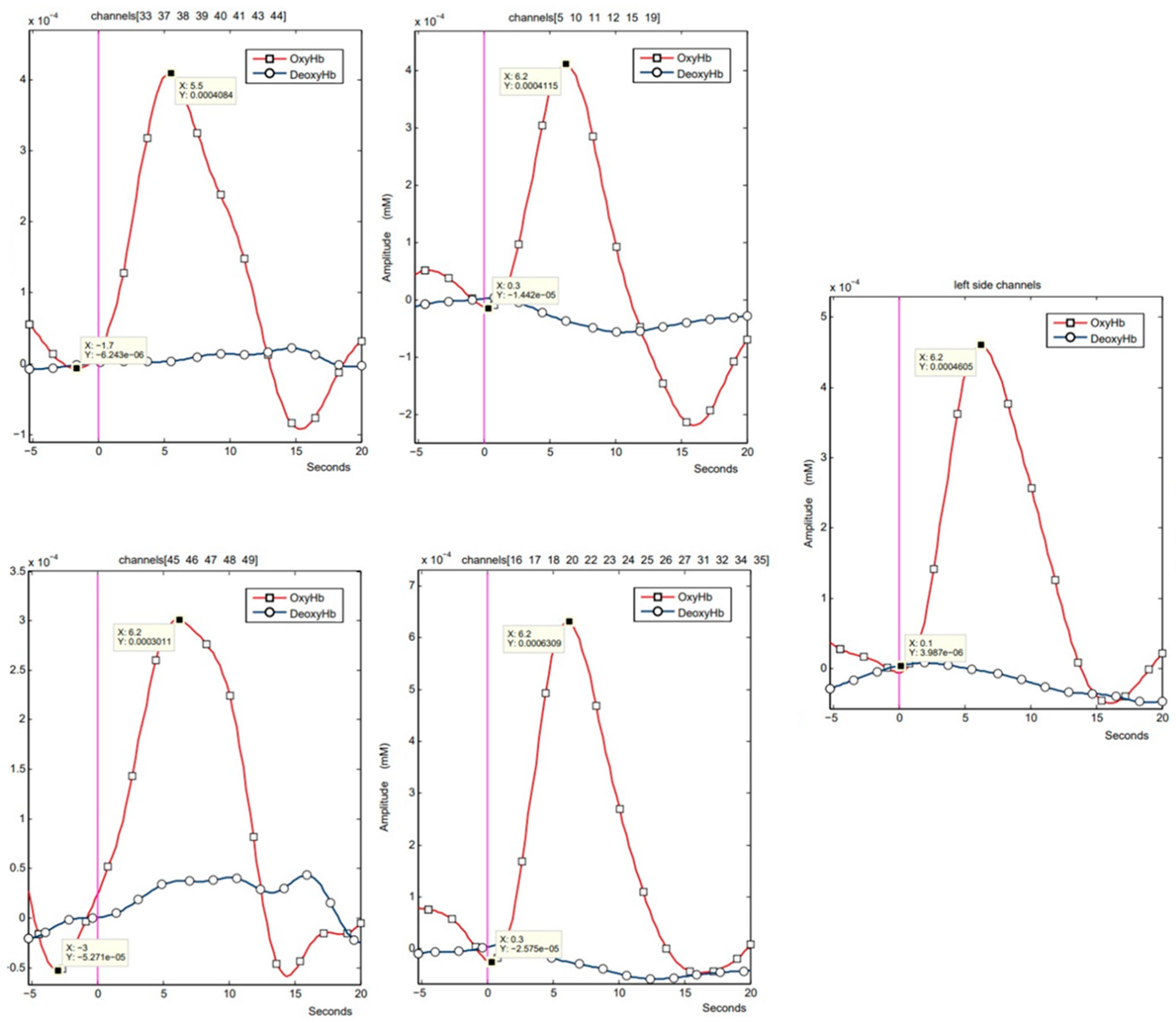 Sensors 25 04135 g004