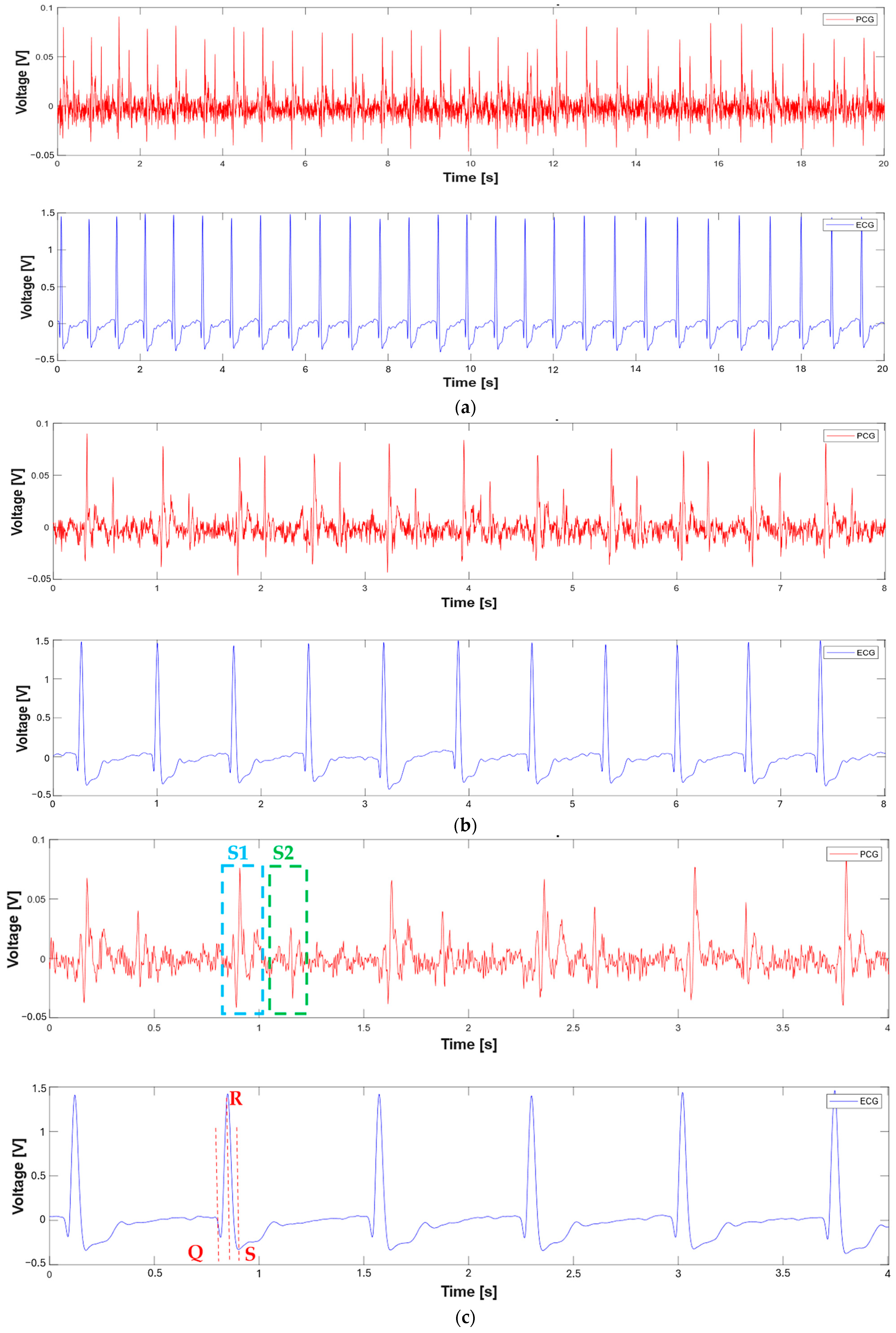 Sensors 25 04220 g004