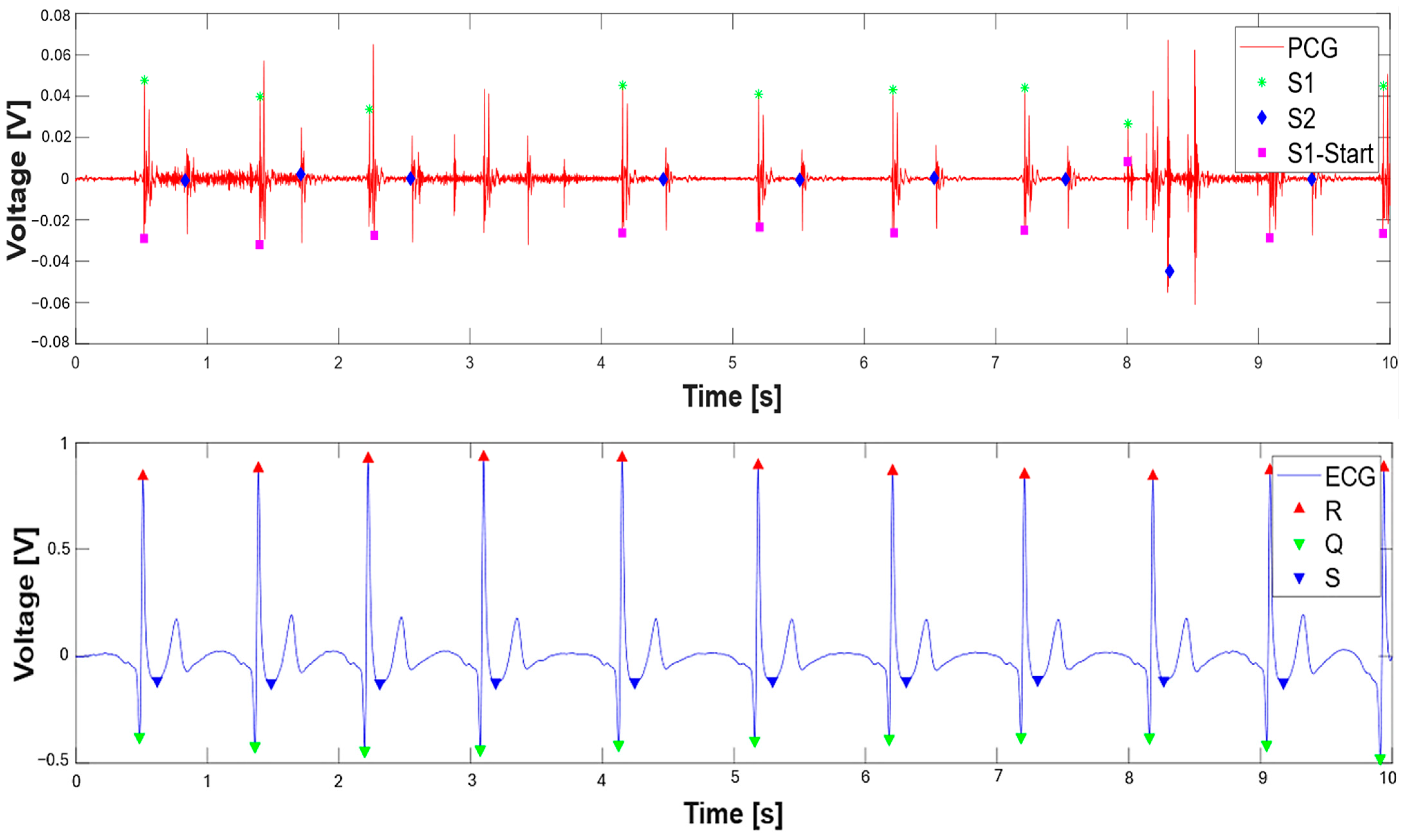 Sensors 25 04220 g014