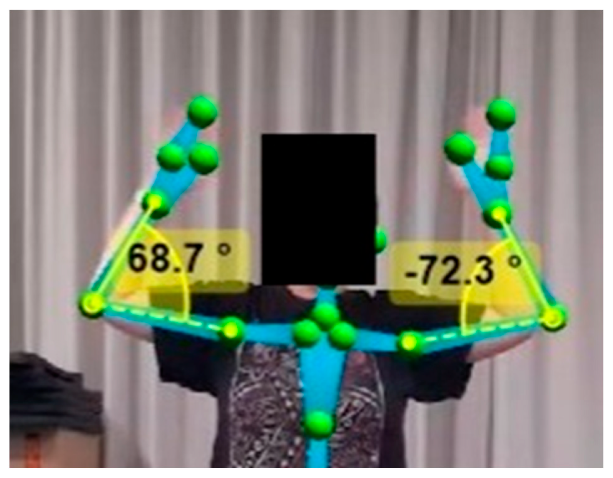 Sensors 25 04269 g003