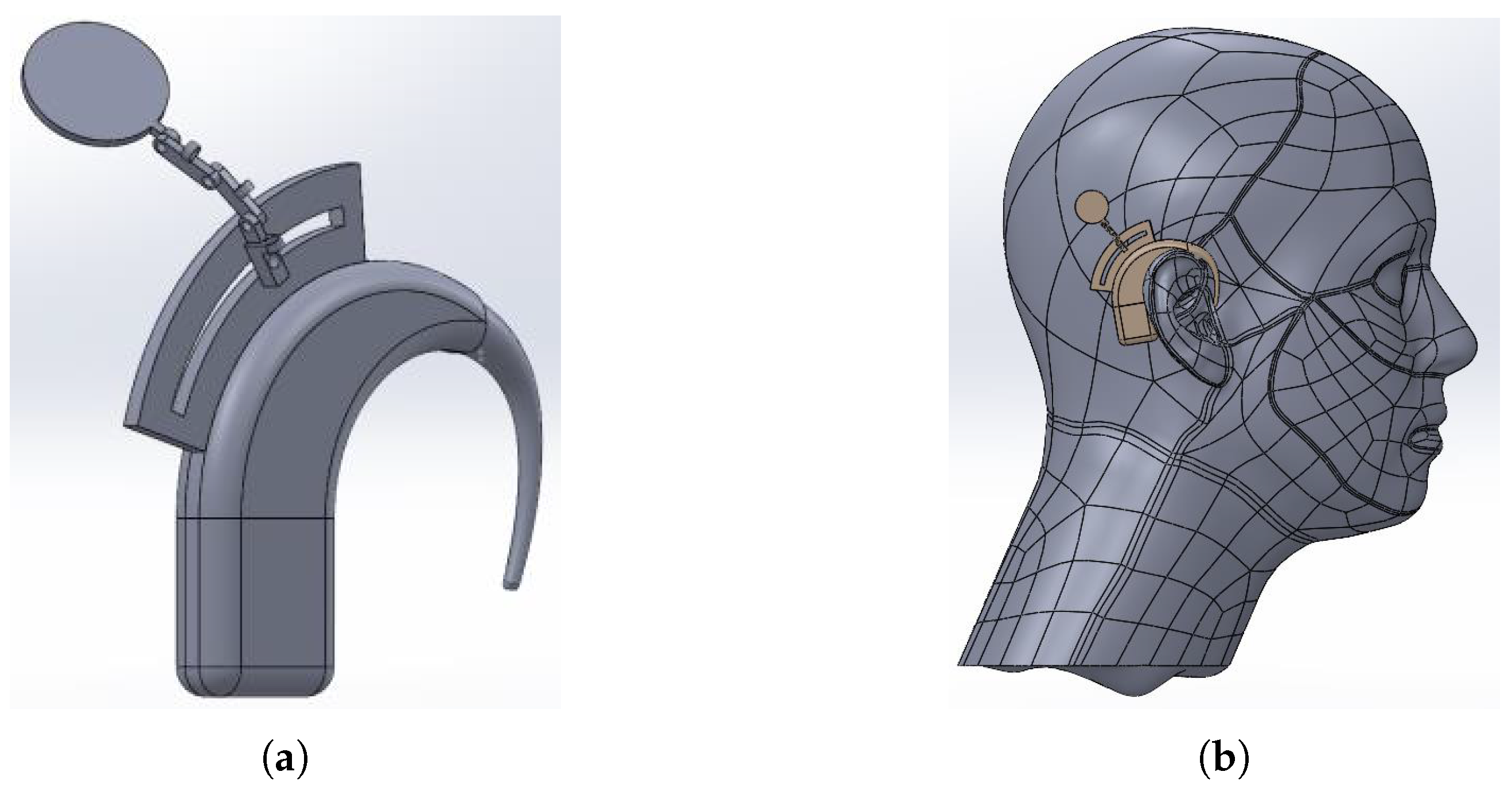 Sensors 25 04379 g010