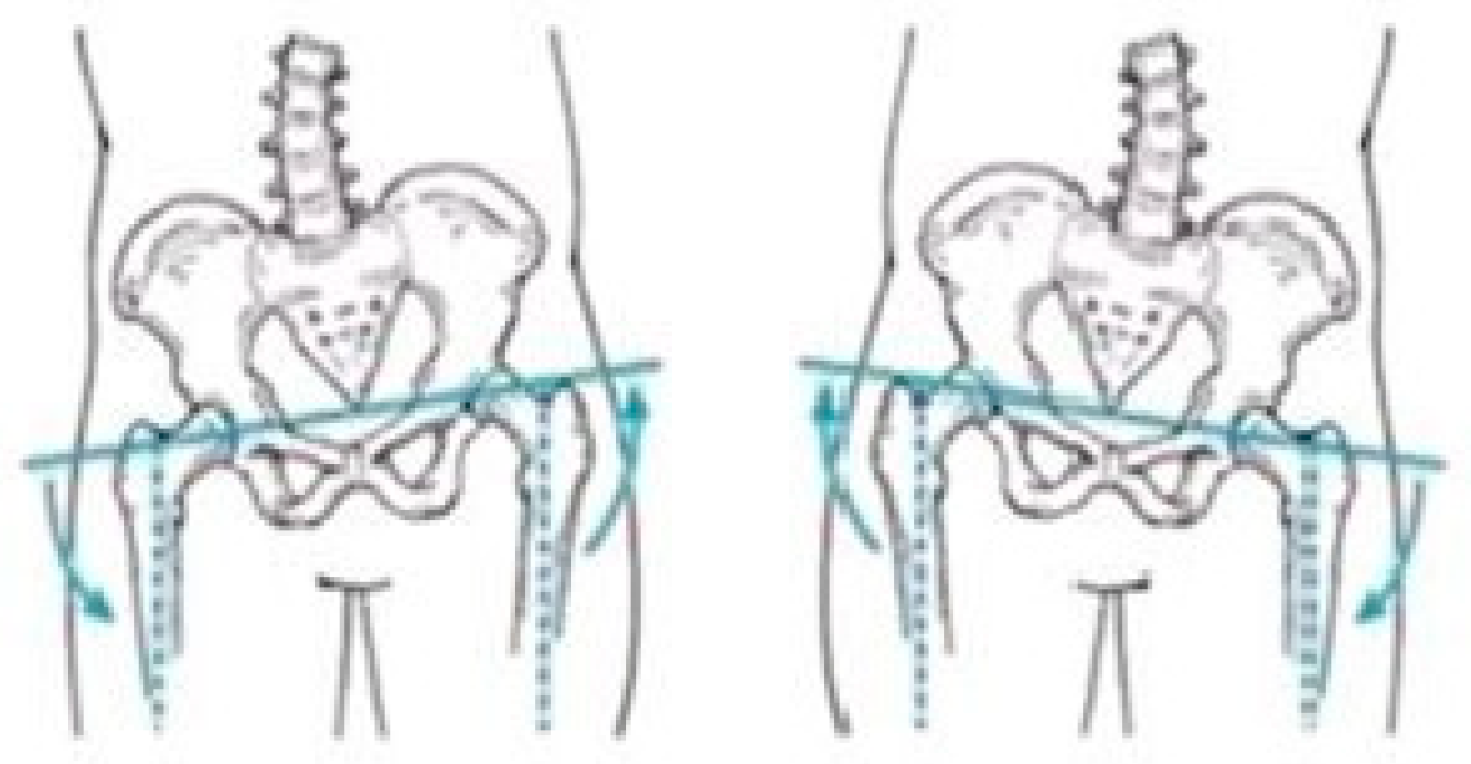 Sensors 25 04435 g004