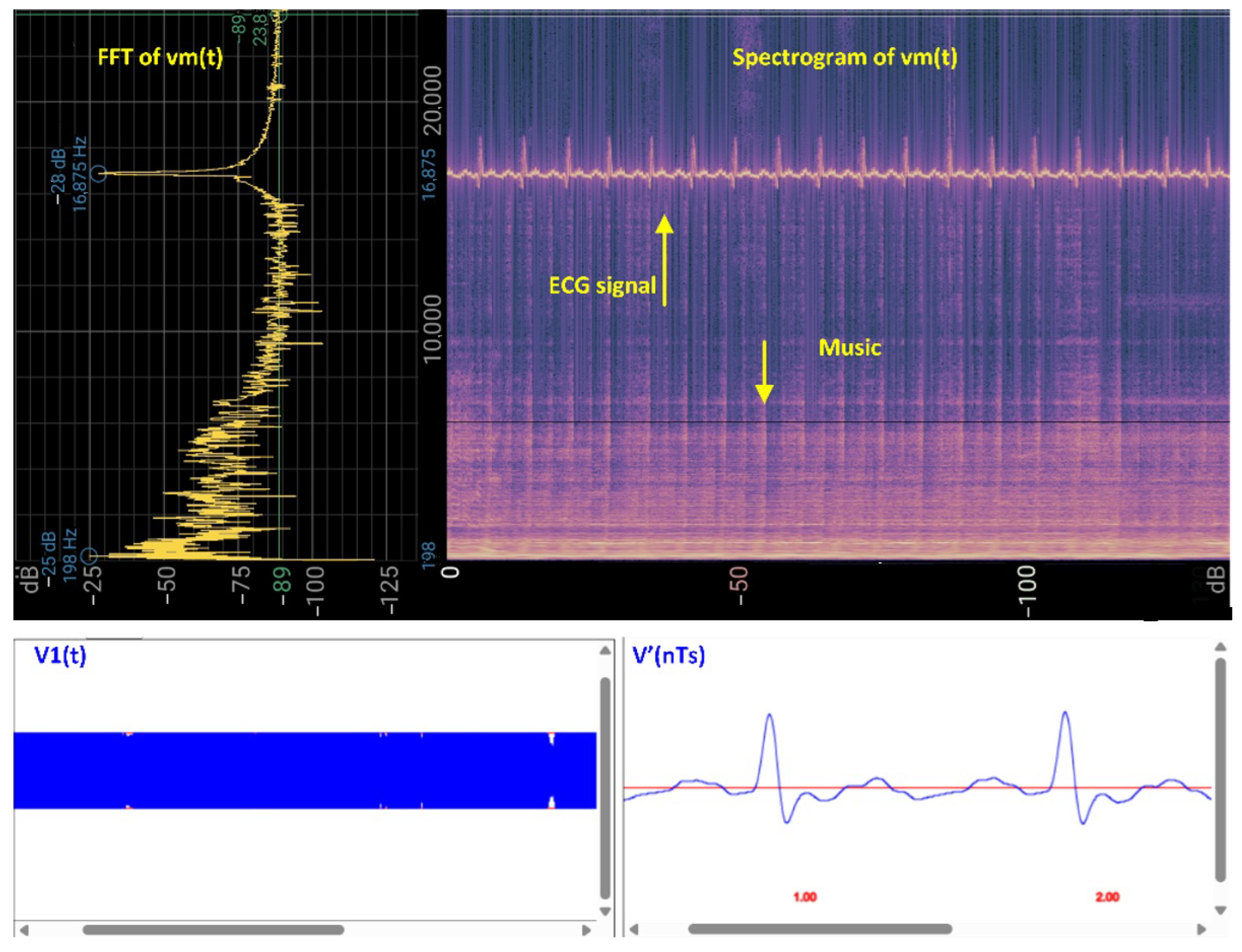 Sensors 25 04573 g006