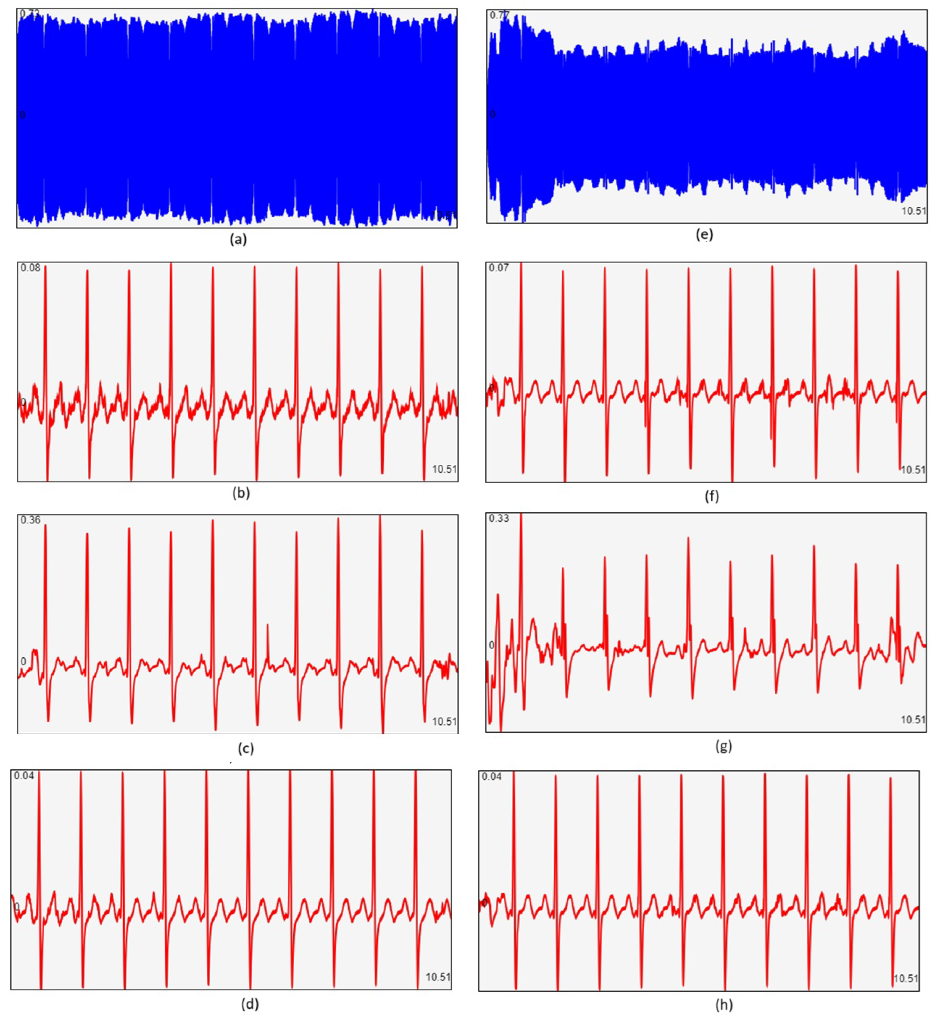 Sensors 25 04573 g011