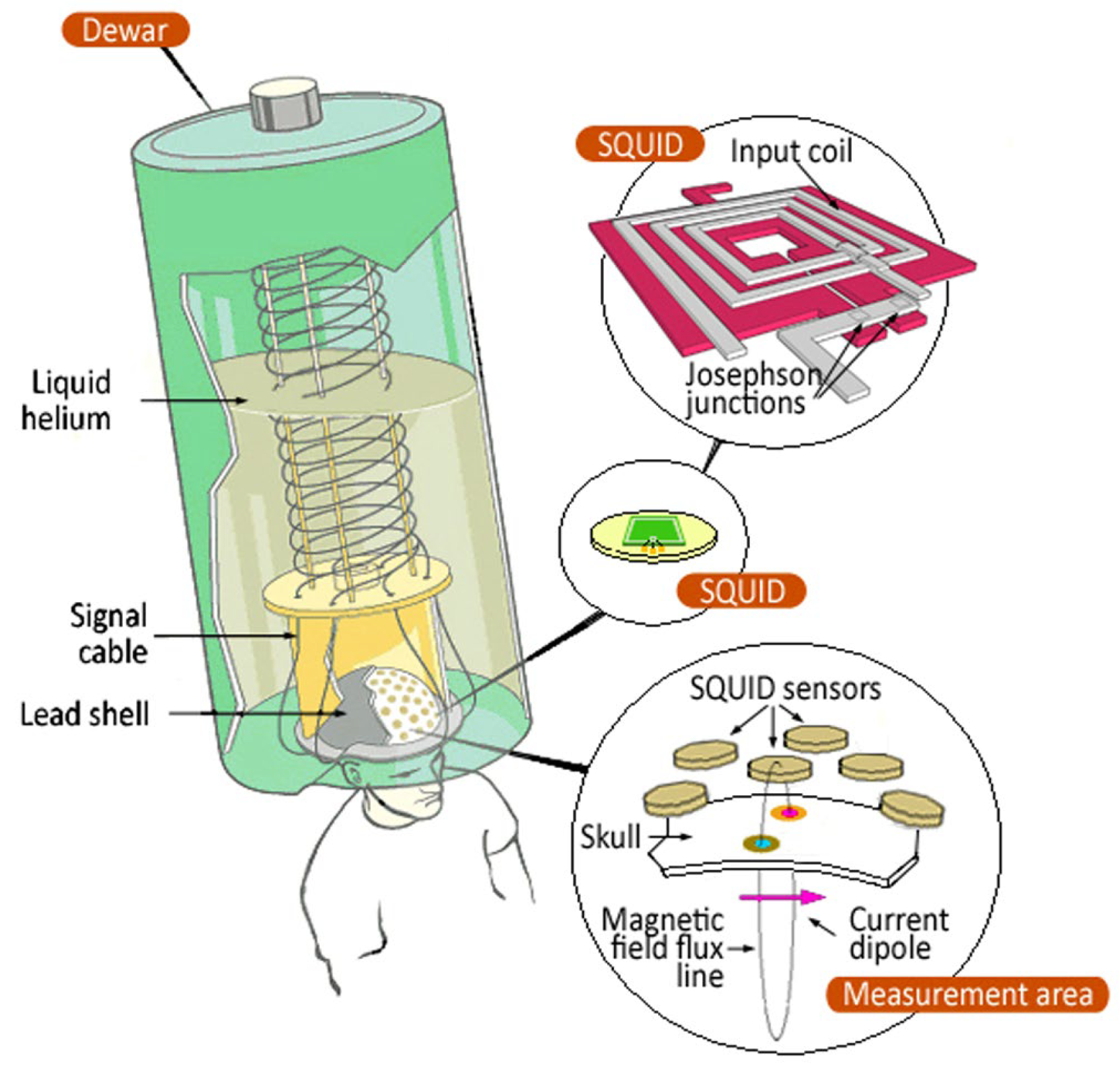 Sensors 25 04625 g014