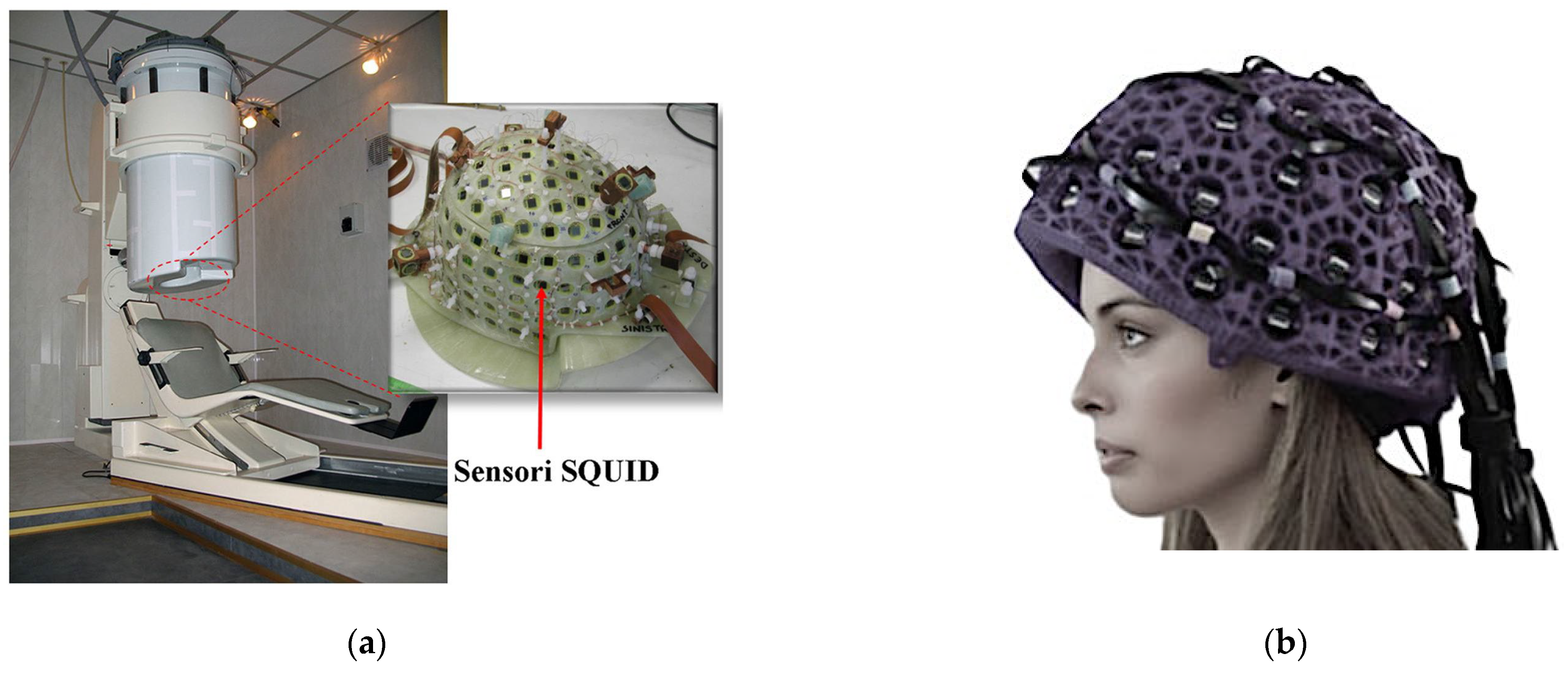 Sensors 25 04625 g016