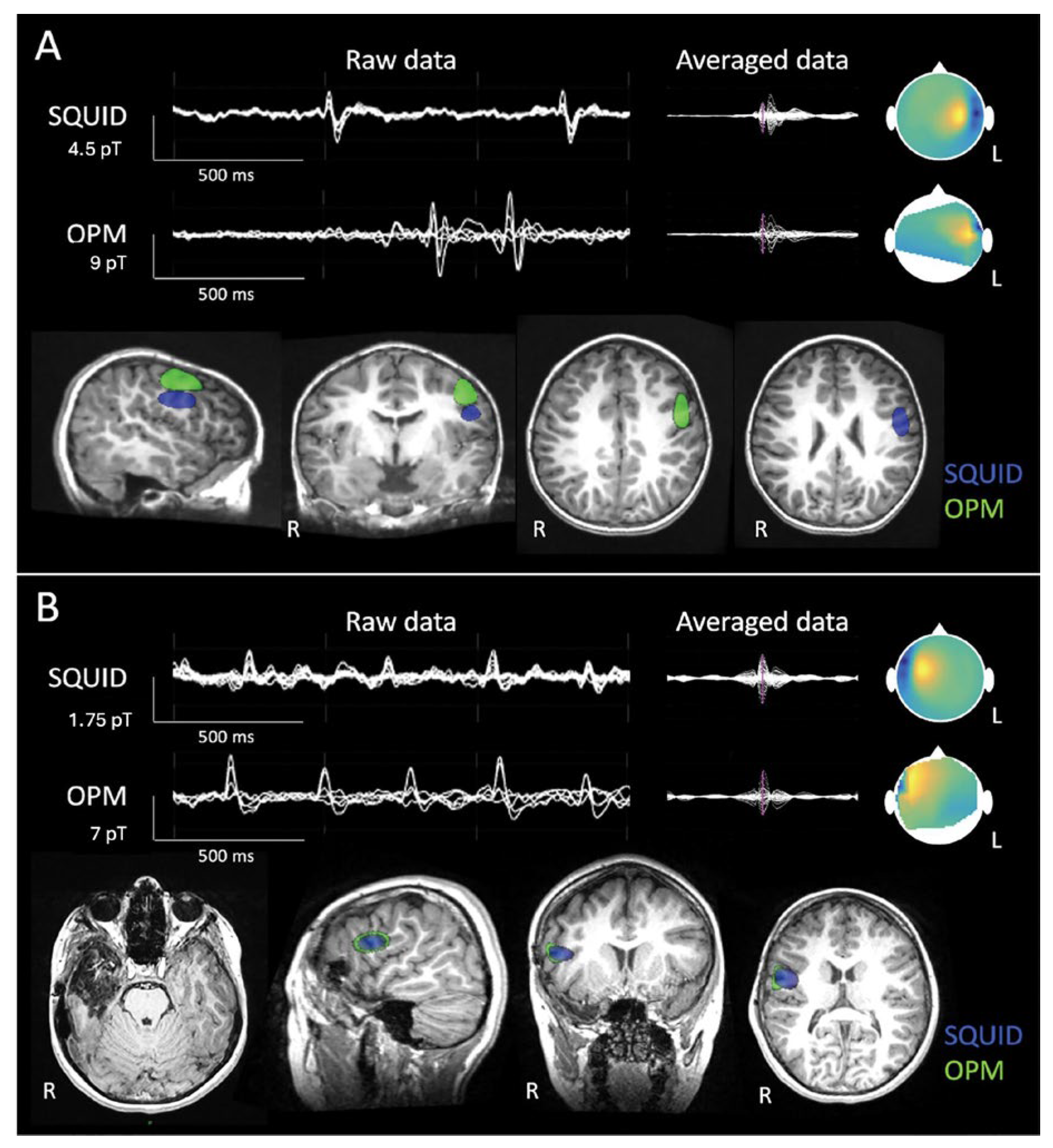Sensors 25 04625 g017