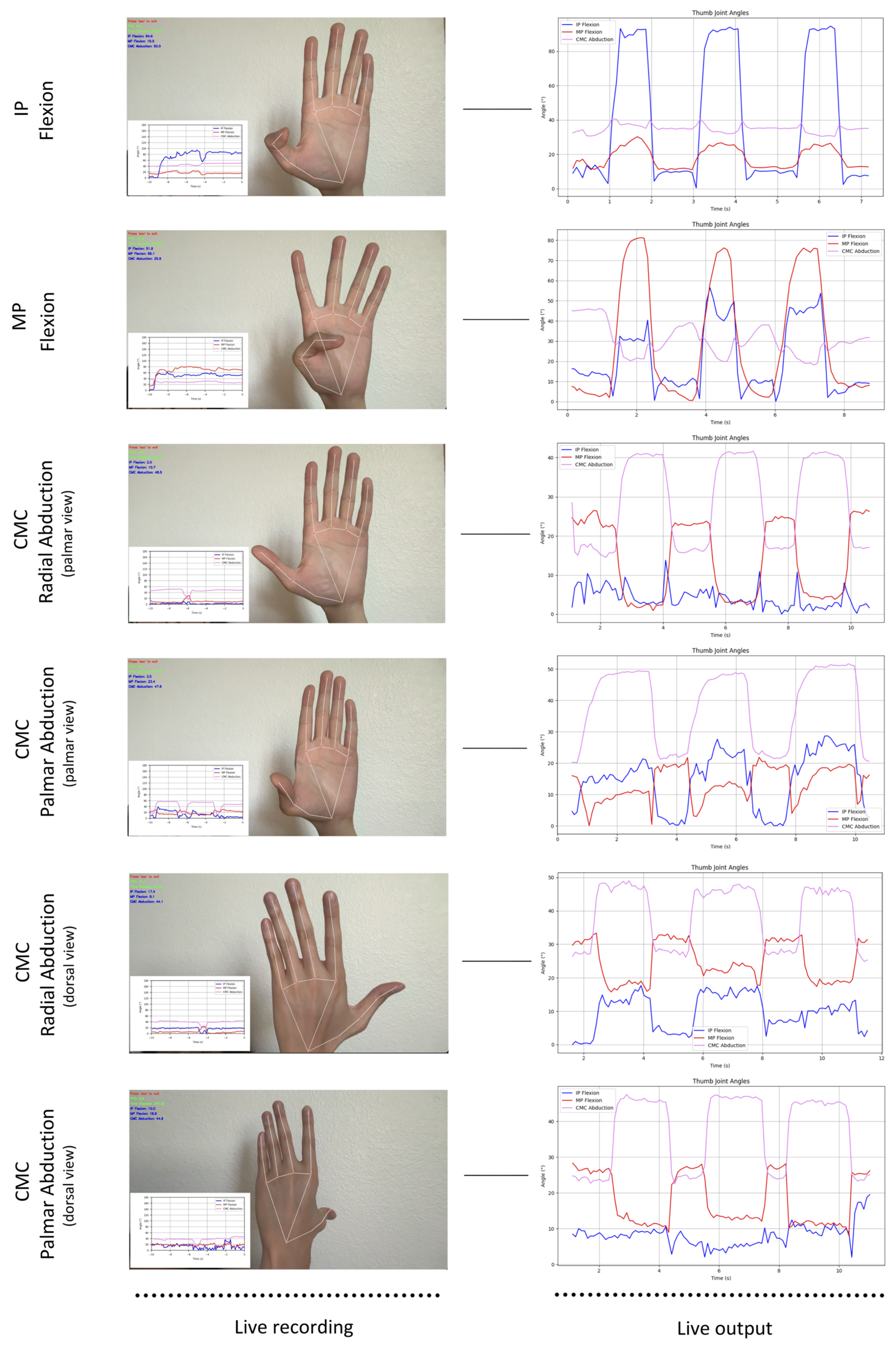 Sensors 25 04633 g004