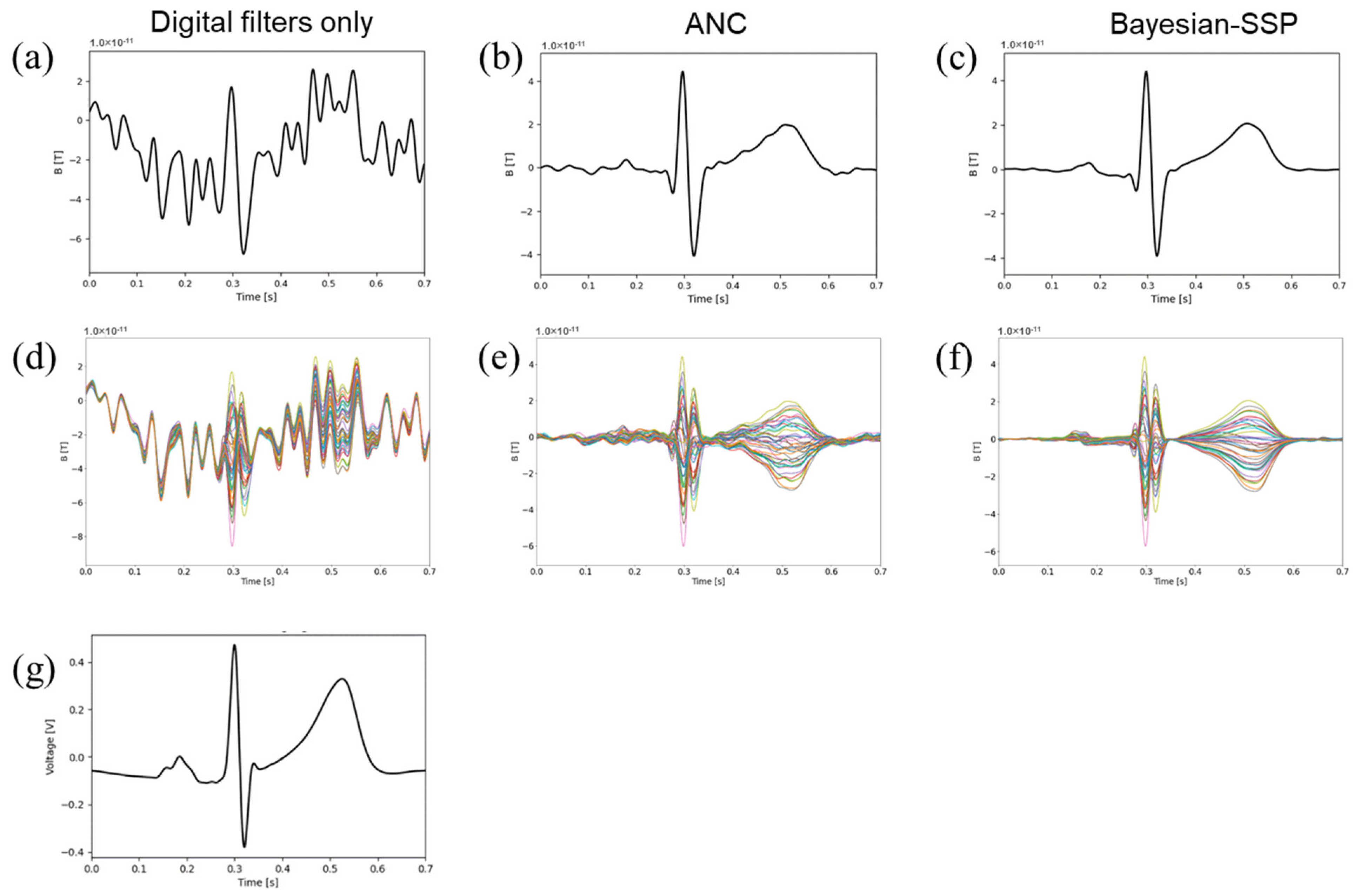 Sensors 25 04642 g004