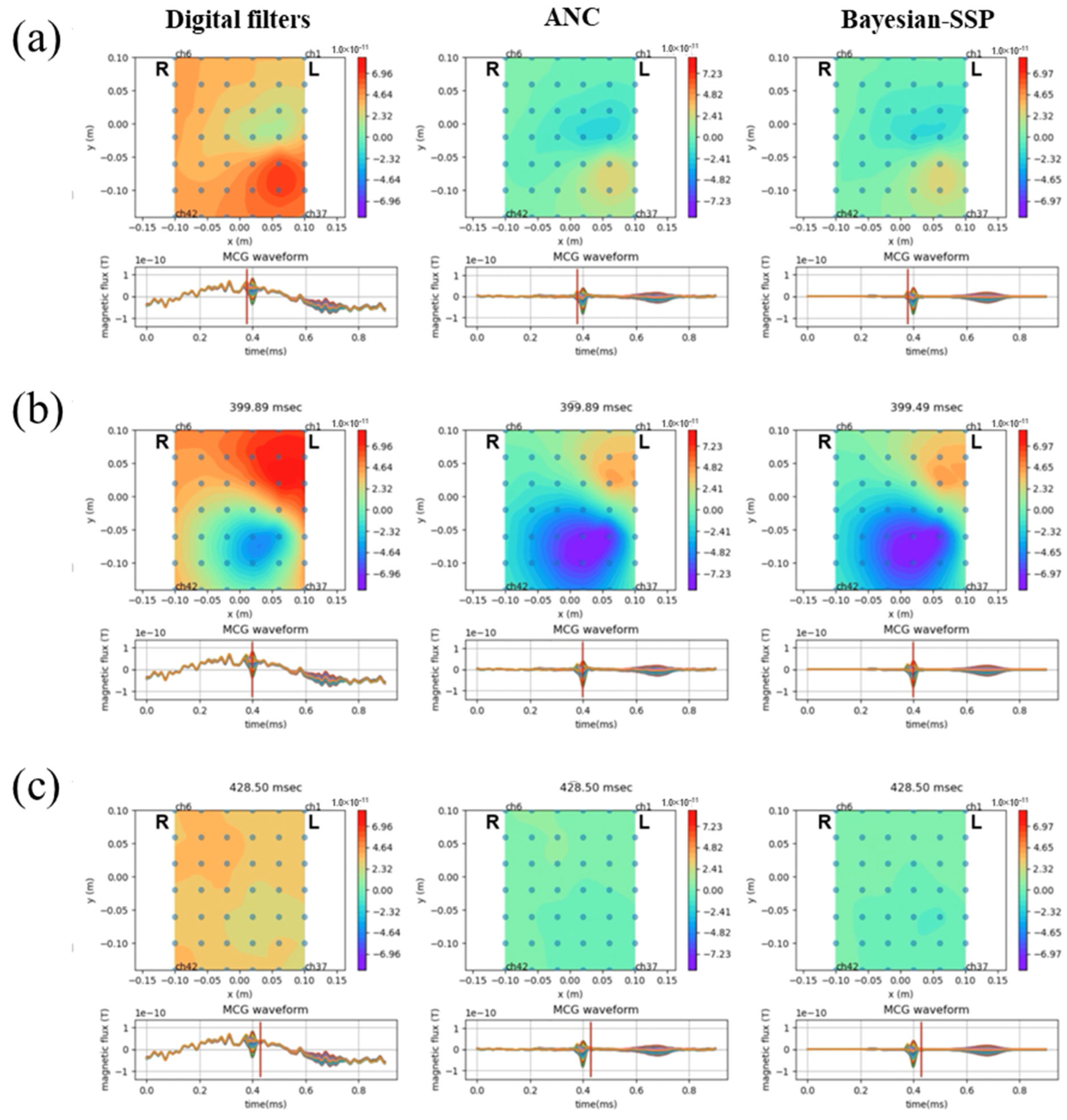Sensors 25 04642 g006
