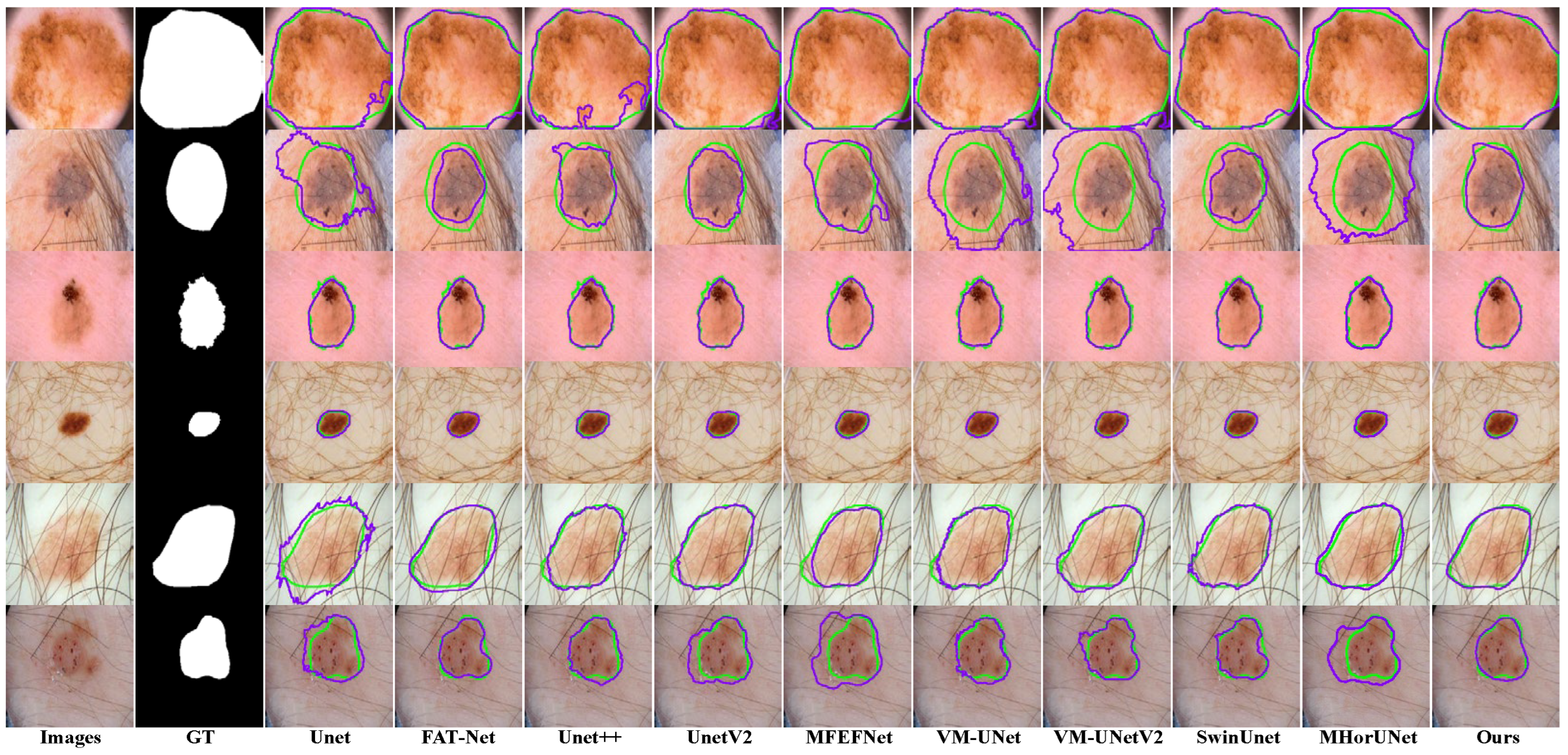 Sensors 25 04652 g010