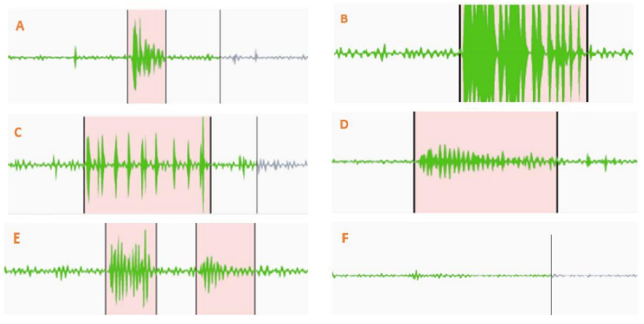 Sensors 25 04735 g002