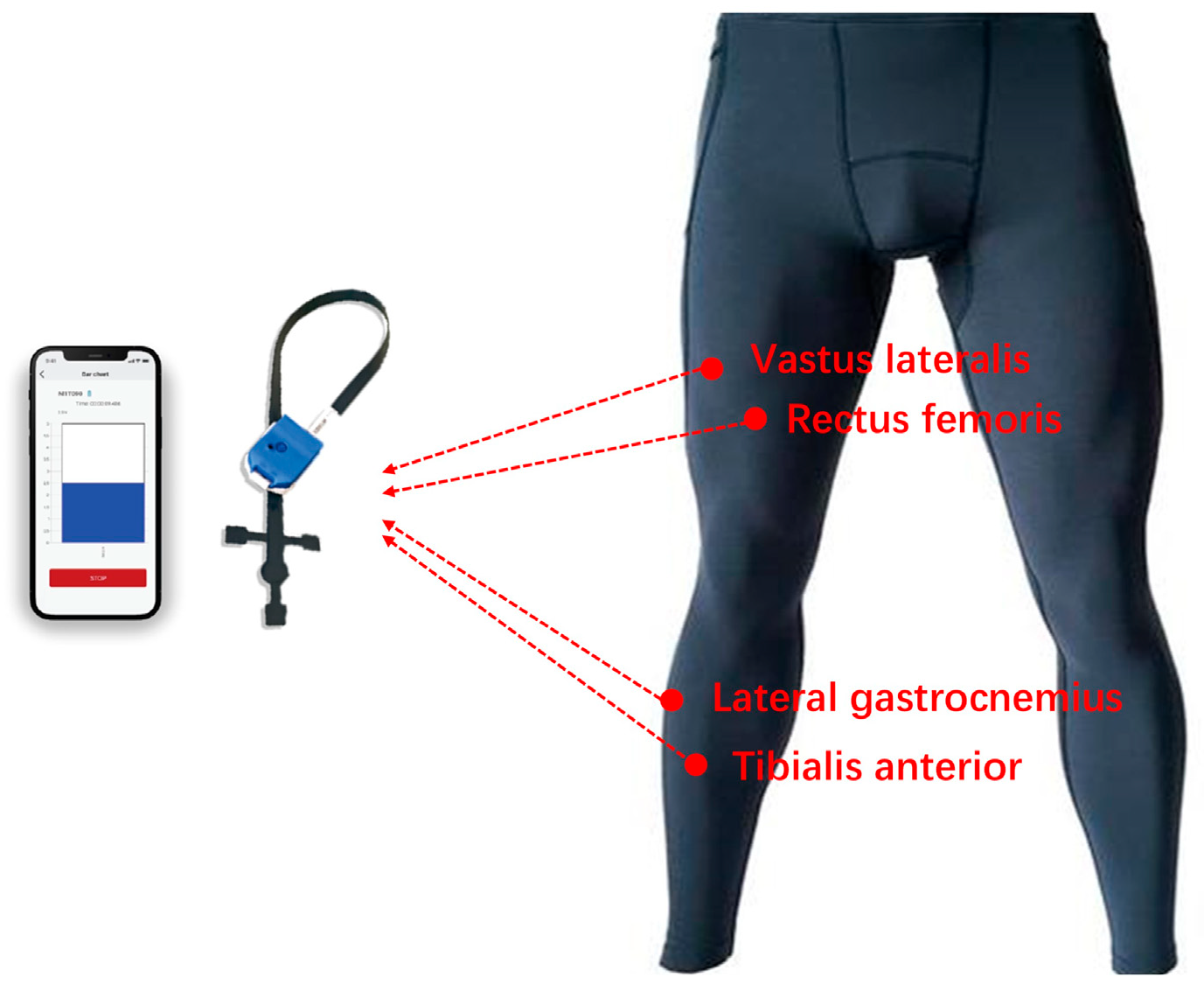 Sensors 25 04875 g002 Sensors 25 04875 g002