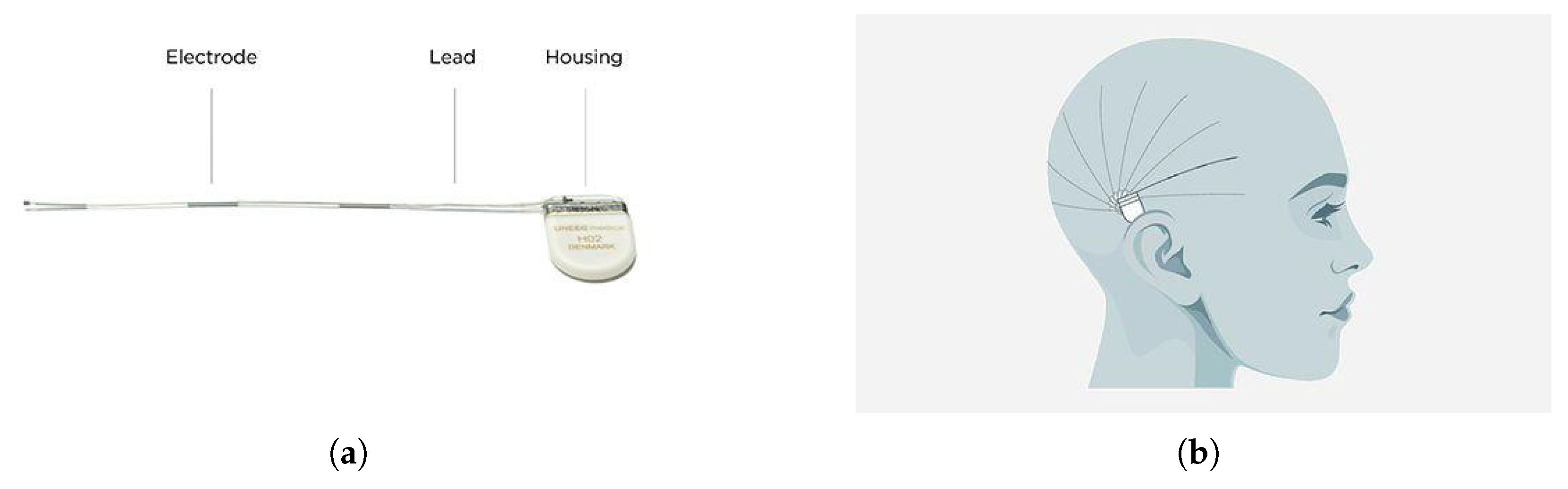 Sensors 25 04932 g001