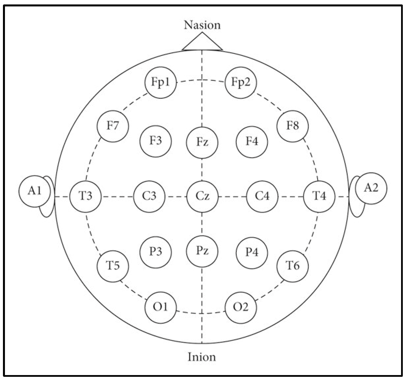 Sensors 25 04946 g006