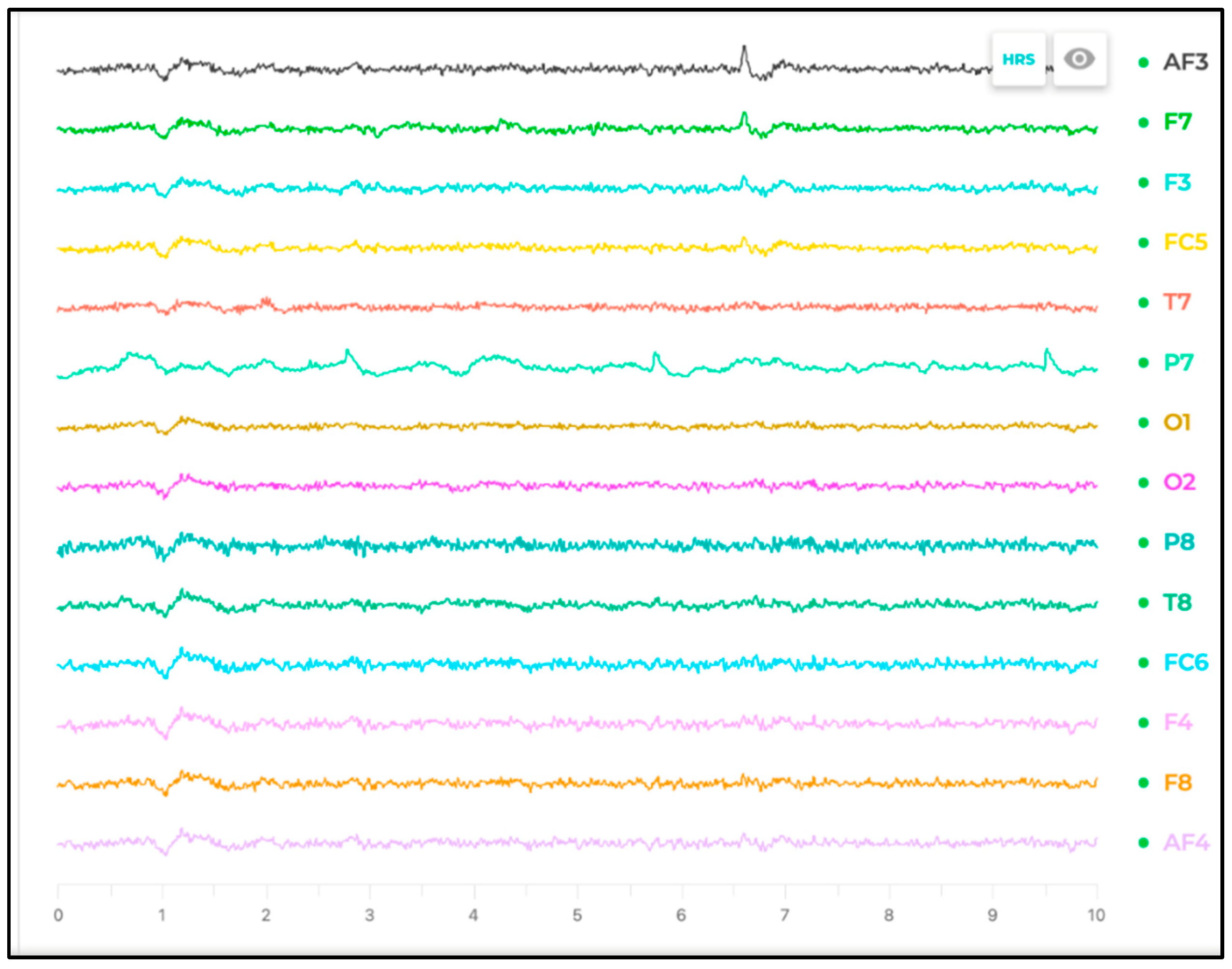 Sensors 25 04946 g007