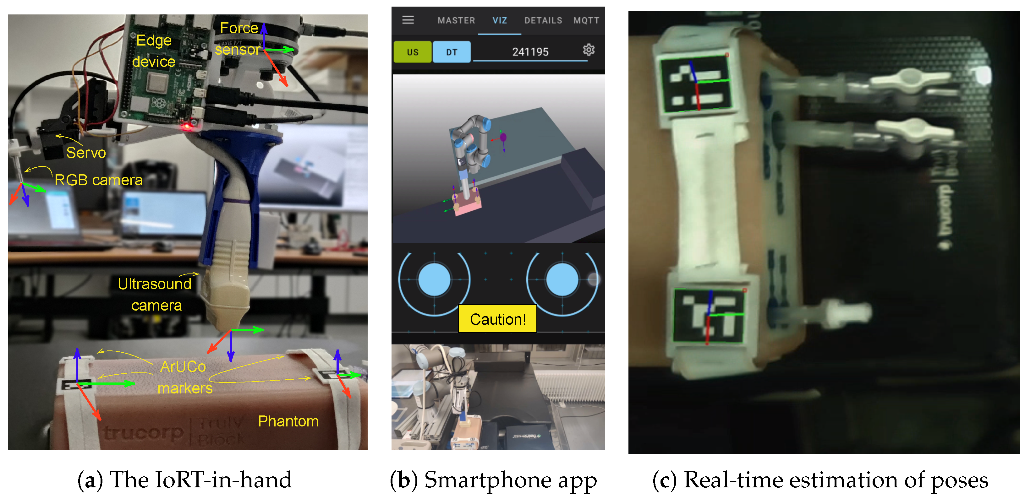 Sensors 25 04972 g005