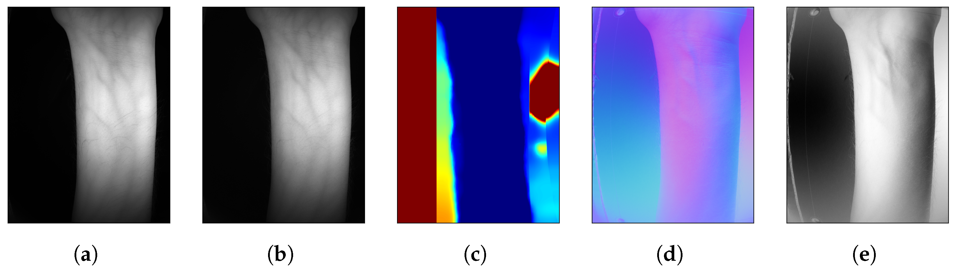 Sensors 25 04990 g005