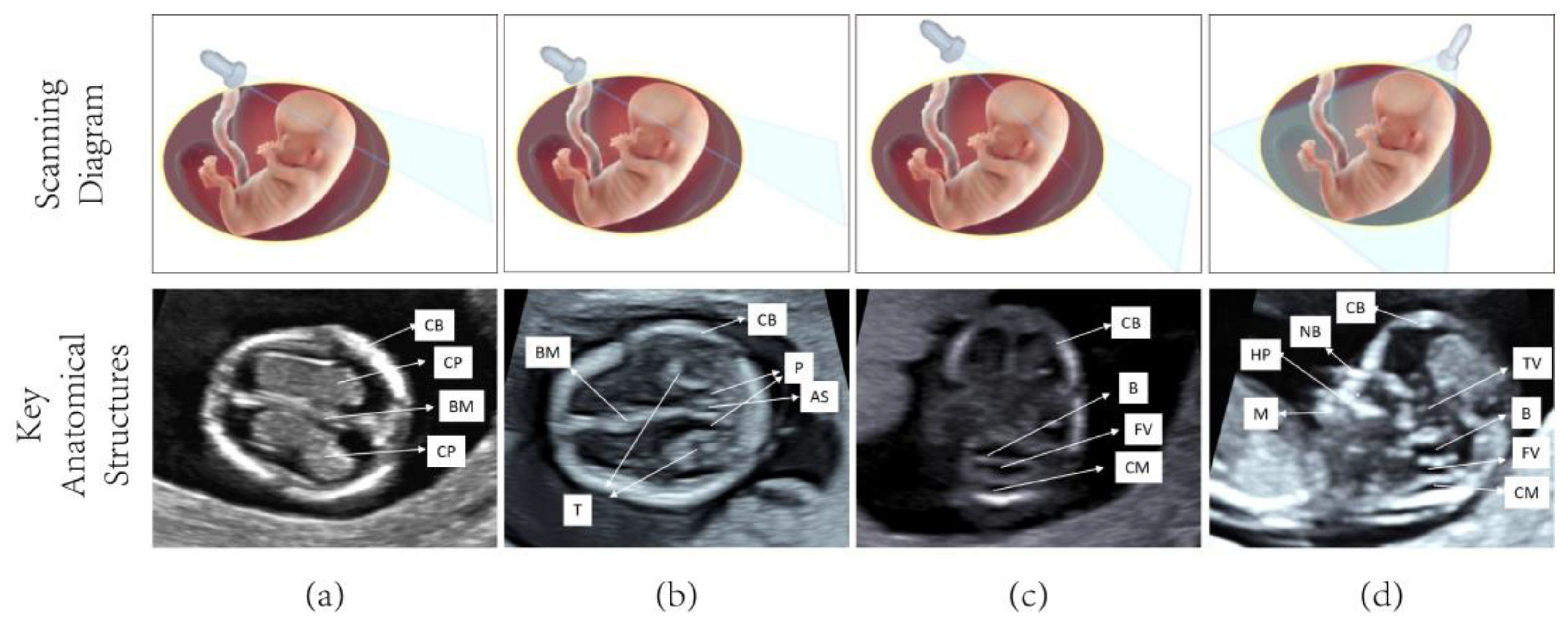 Sensors 25 05034 g004