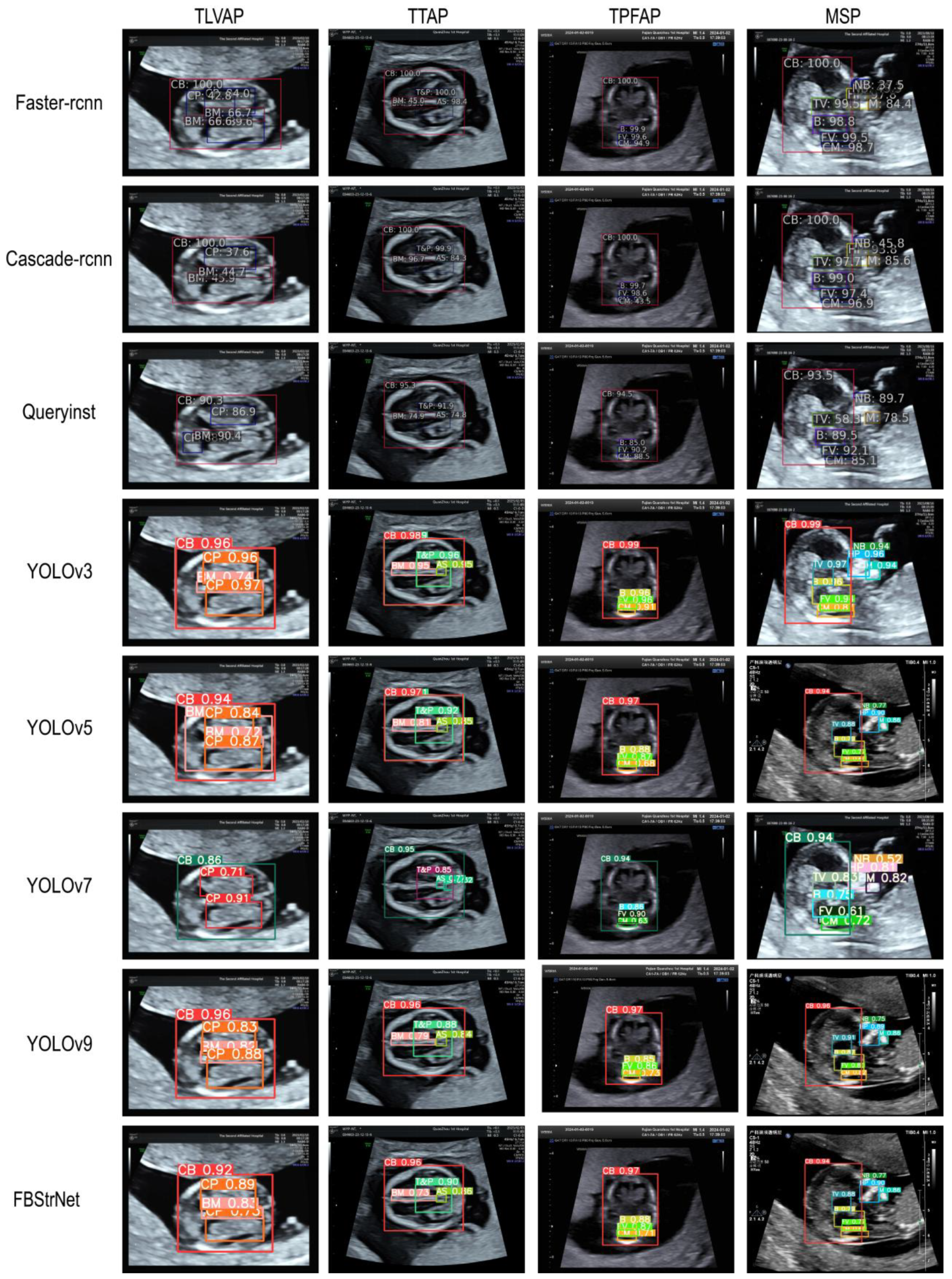Sensors 25 05034 g005
