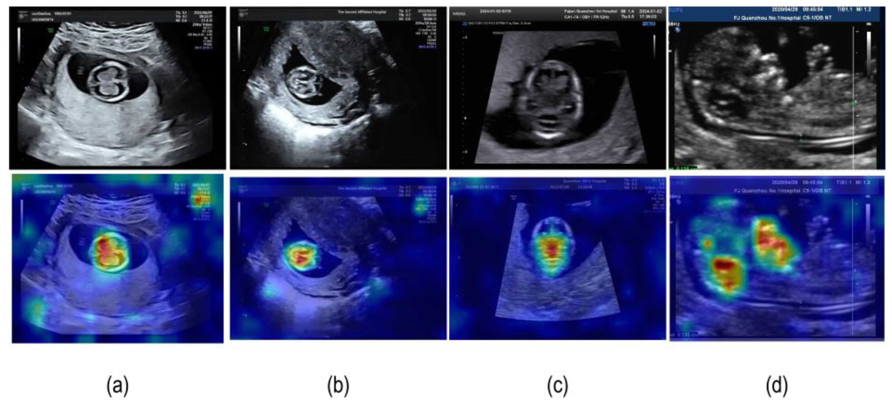 Sensors 25 05034 g007