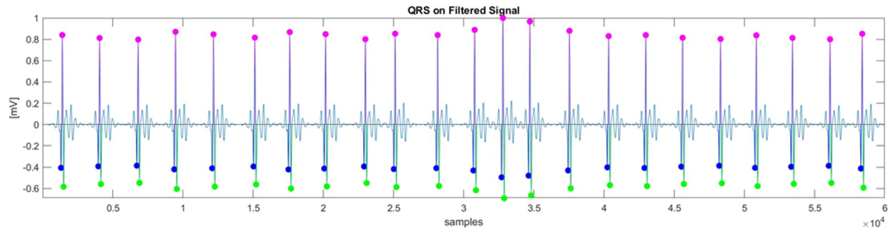 Sensors 25 05136 g002