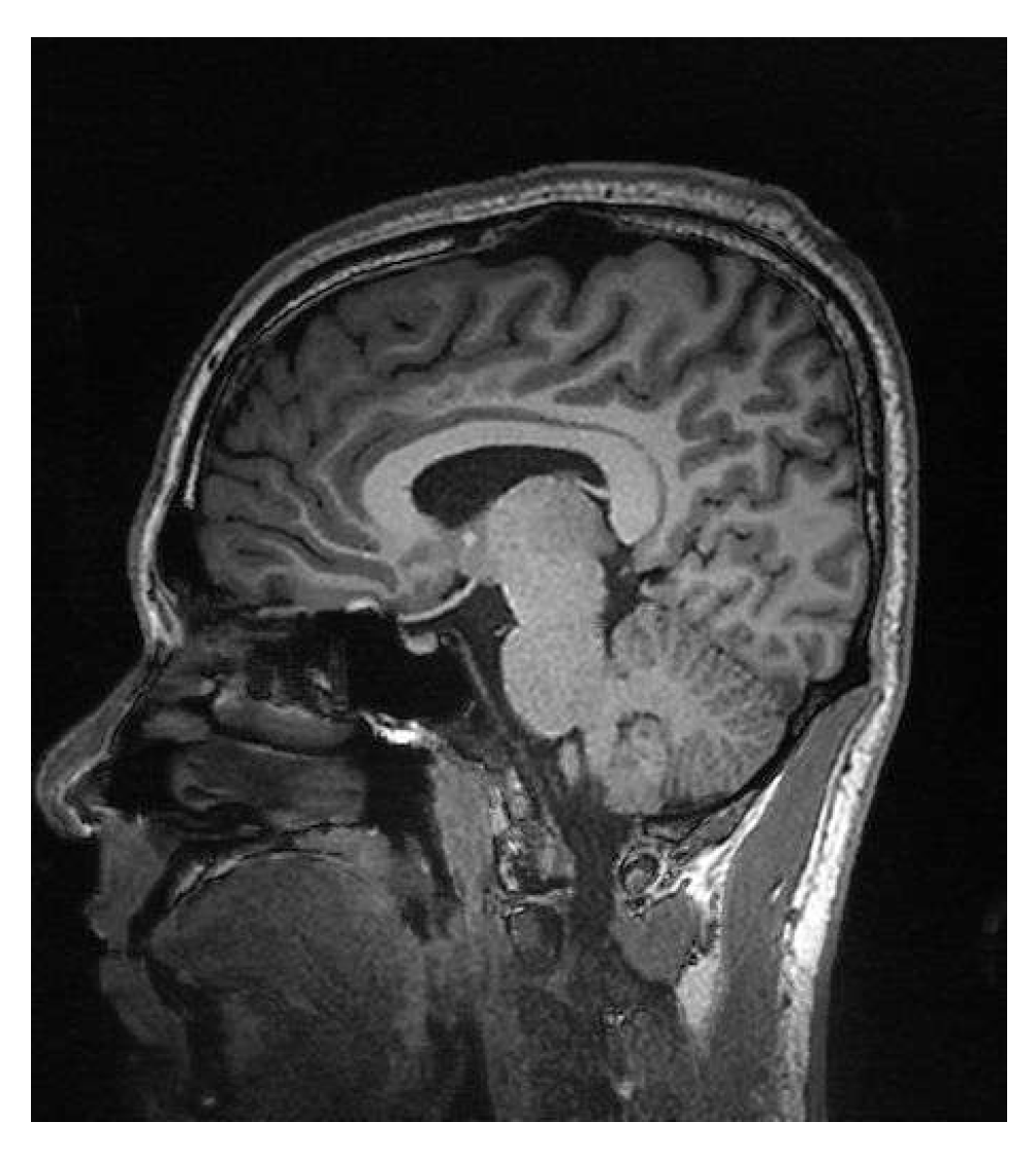 Sensors 25 05137 g003