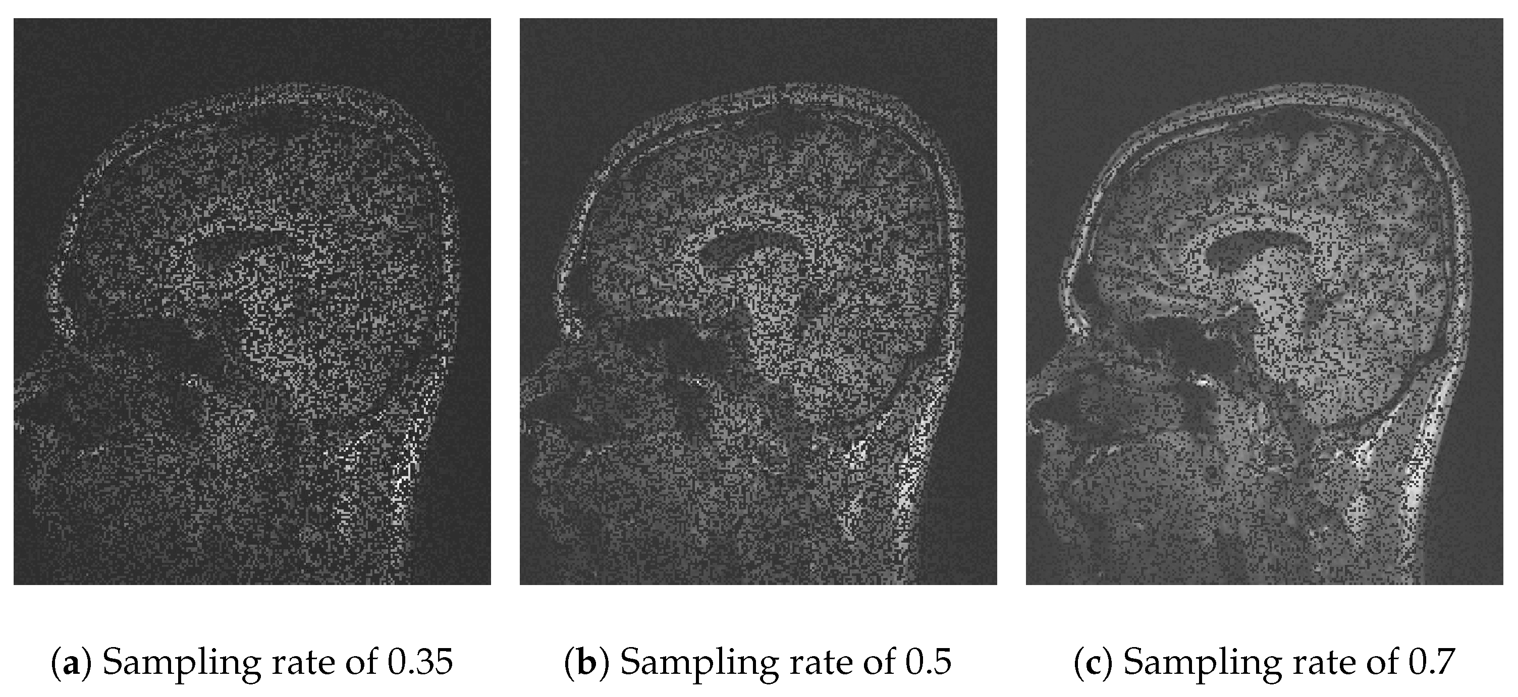 Sensors 25 05137 g004
