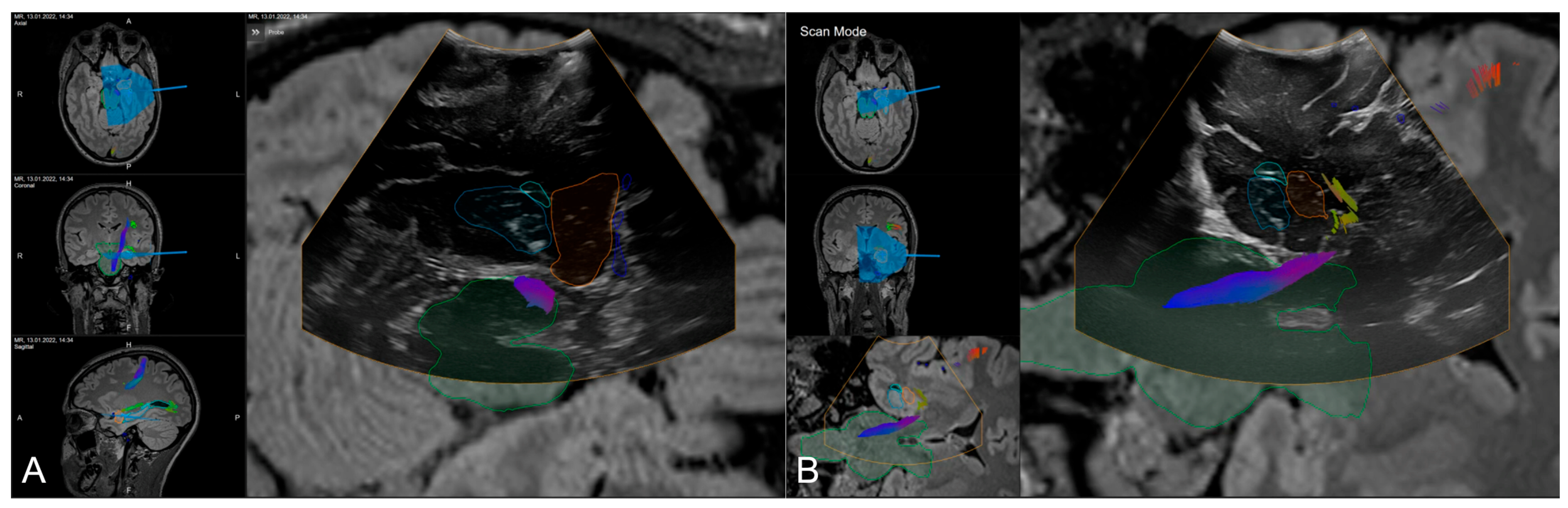 Sensors 25 05301 g005