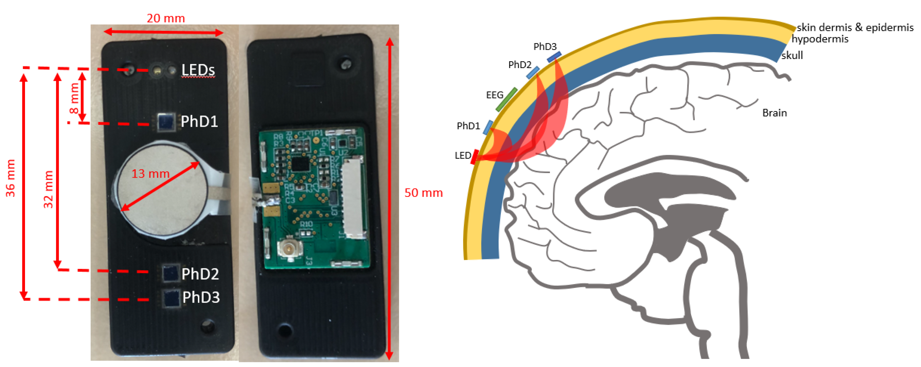 Sensors 25 05520 g002