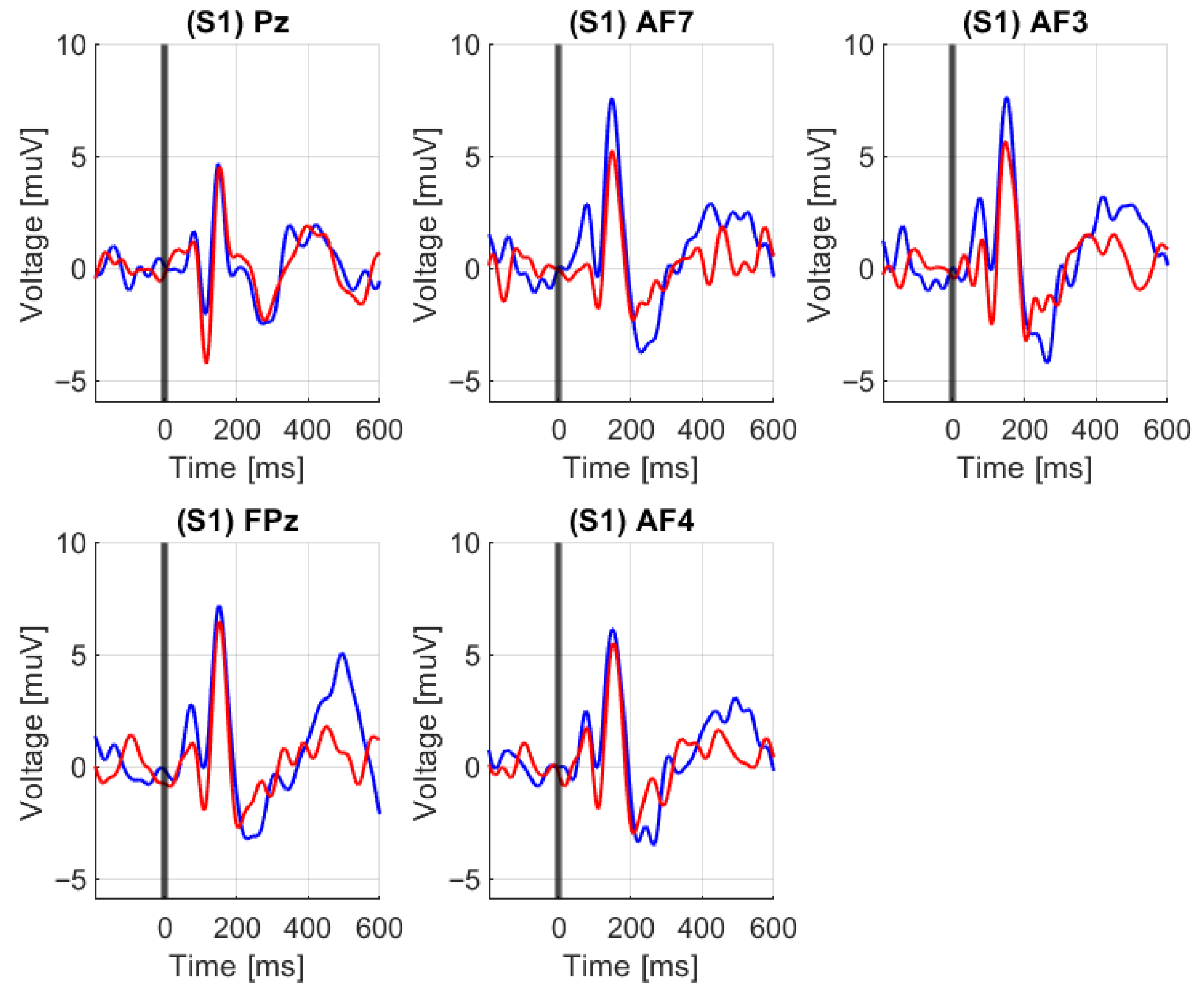 Sensors 25 05520 g015