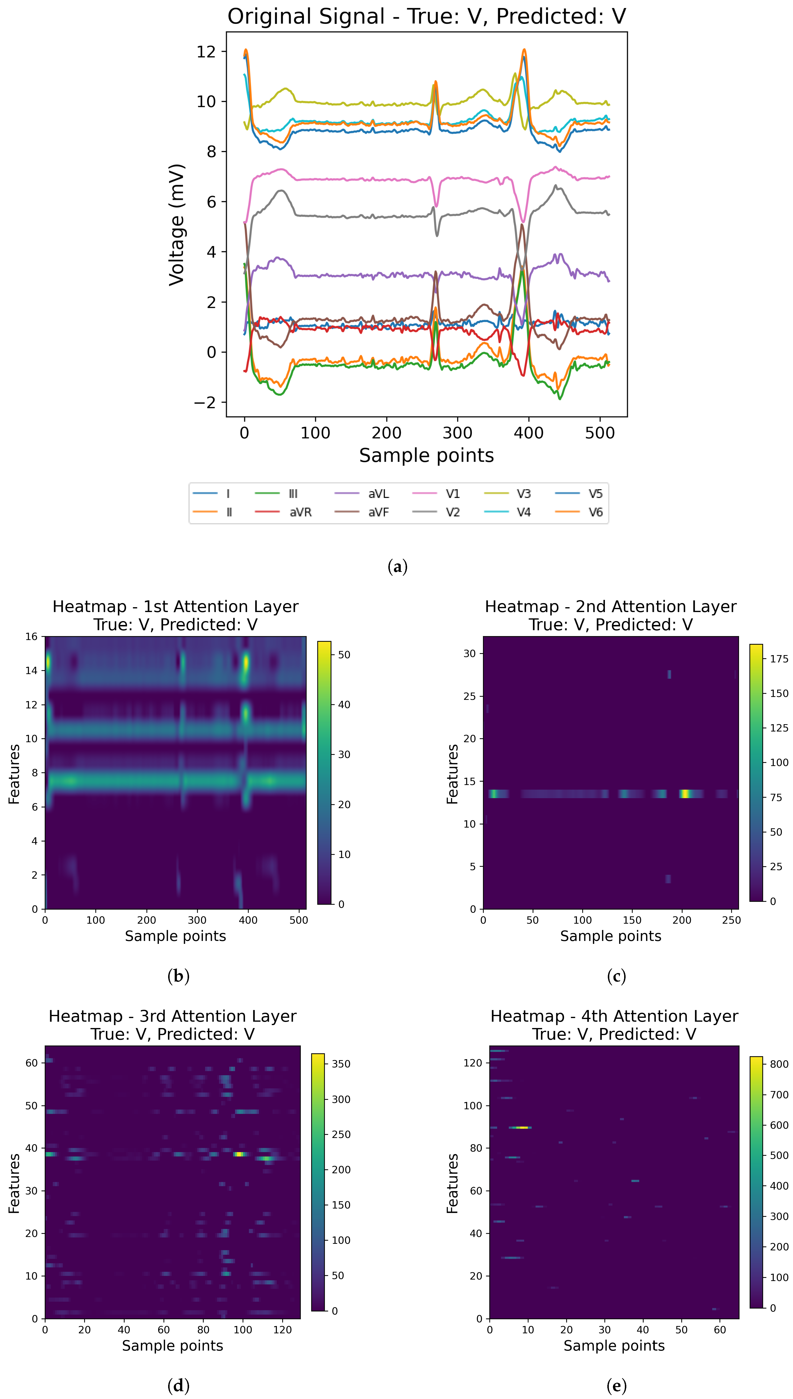 Sensors 25 05542 g014
