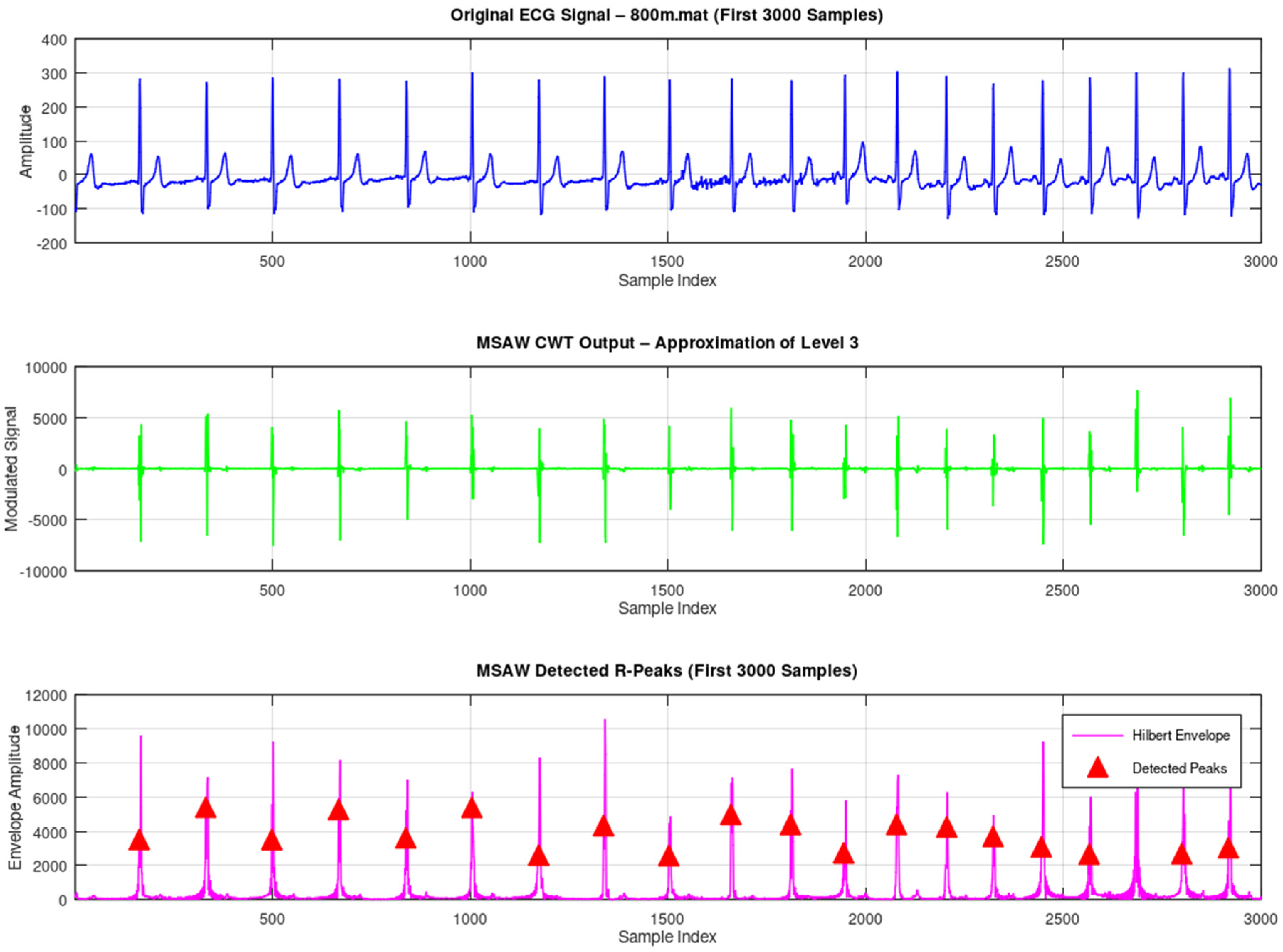 Sensors 25 05591 g011