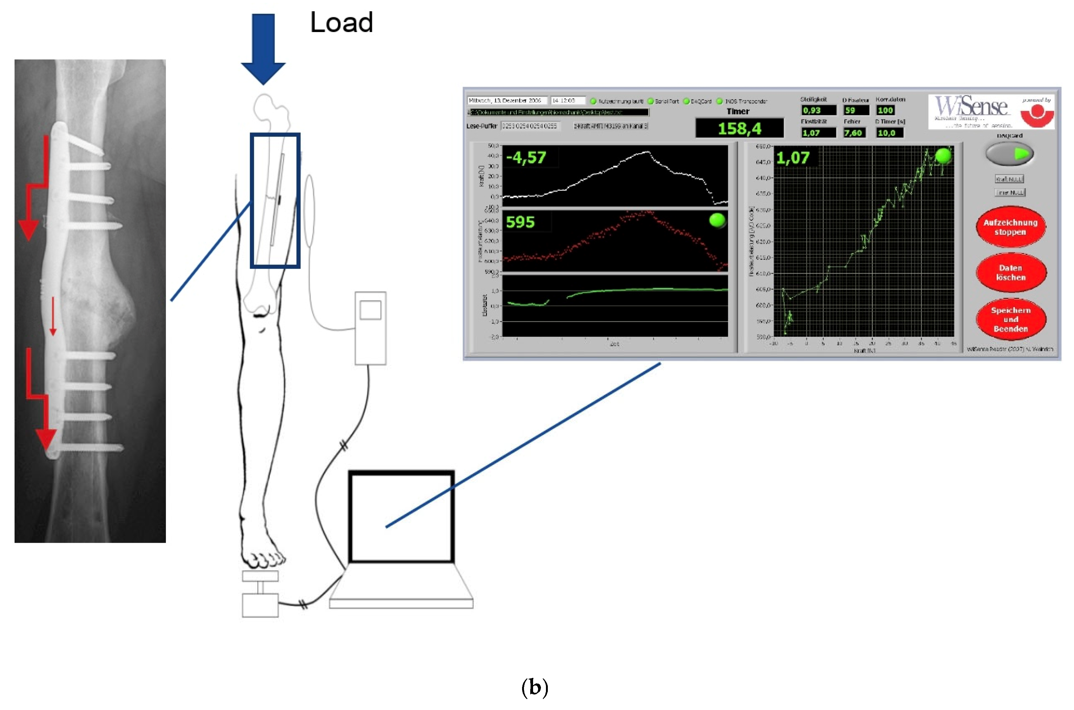 Sensors 25 05779 g003b Sensors 25 05779 g003b