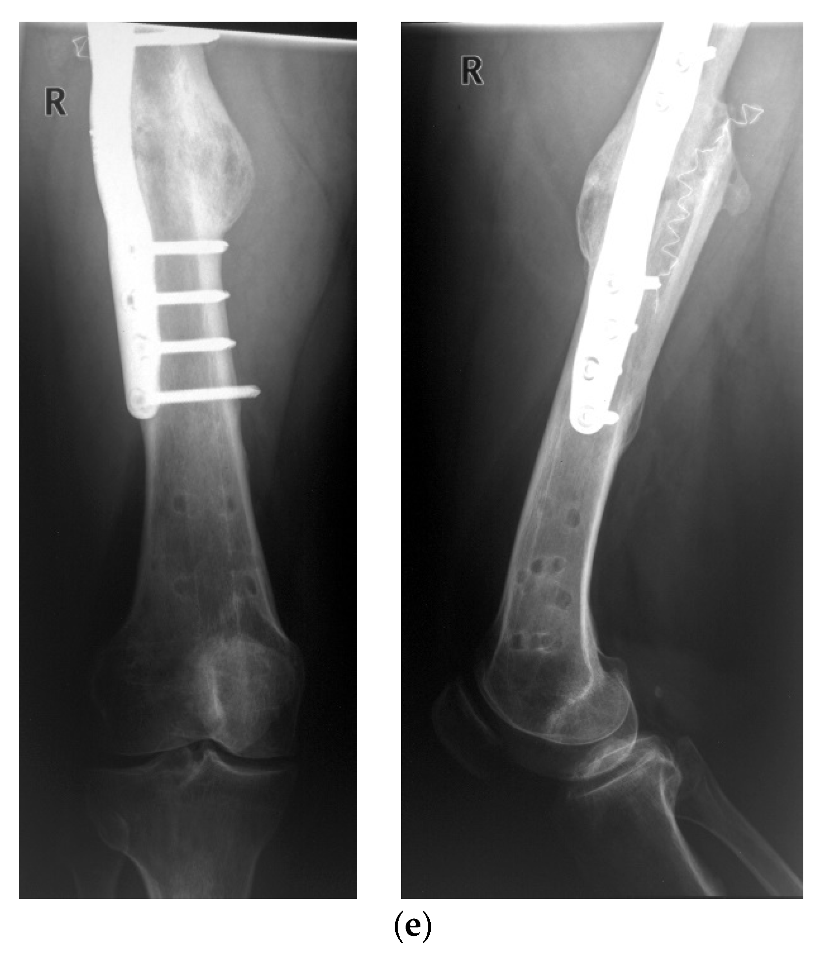 Sensors 25 05779 g006c Sensors 25 05779 g006c
