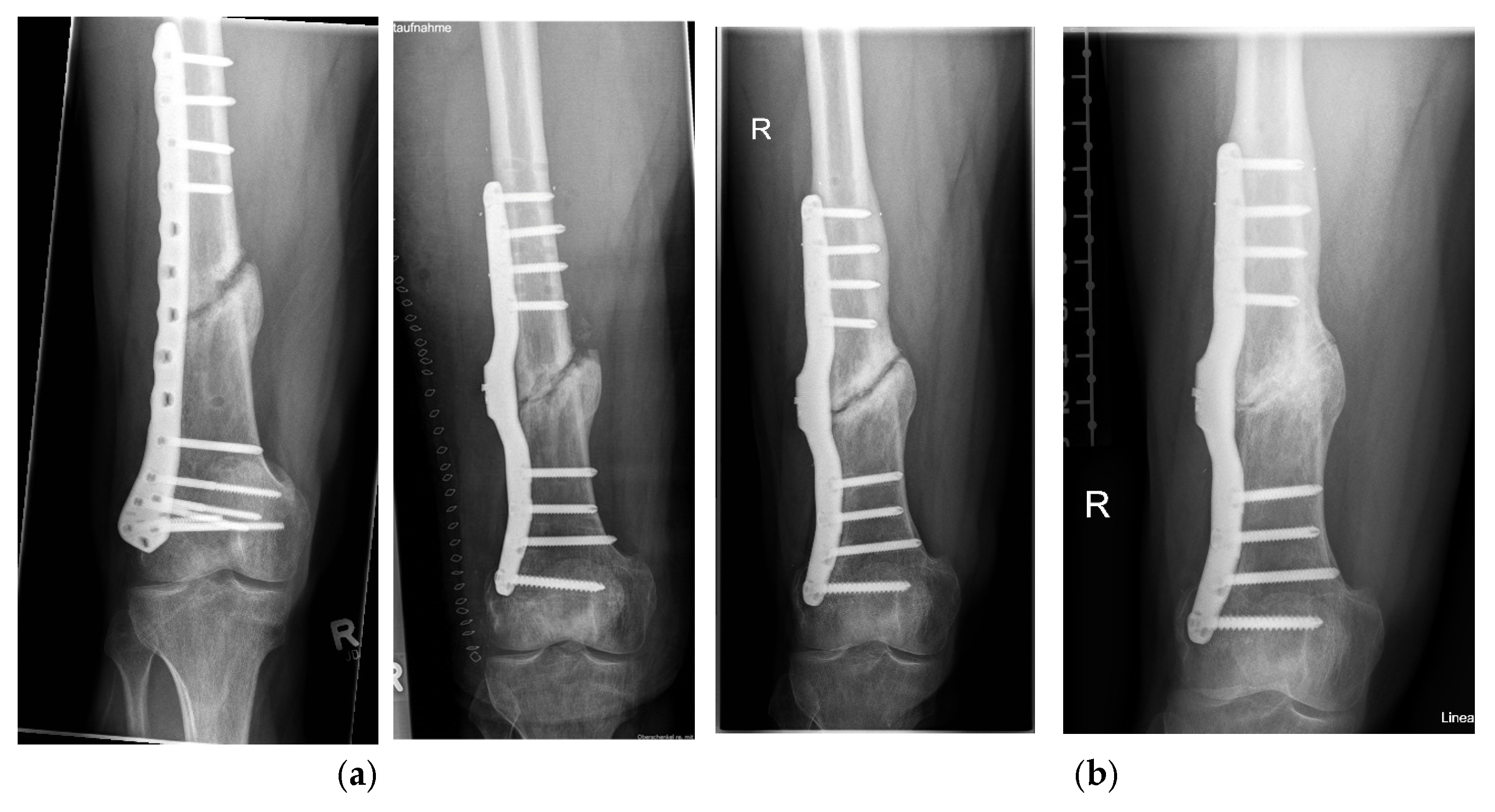 Sensors 25 05779 g009a Sensors 25 05779 g009a